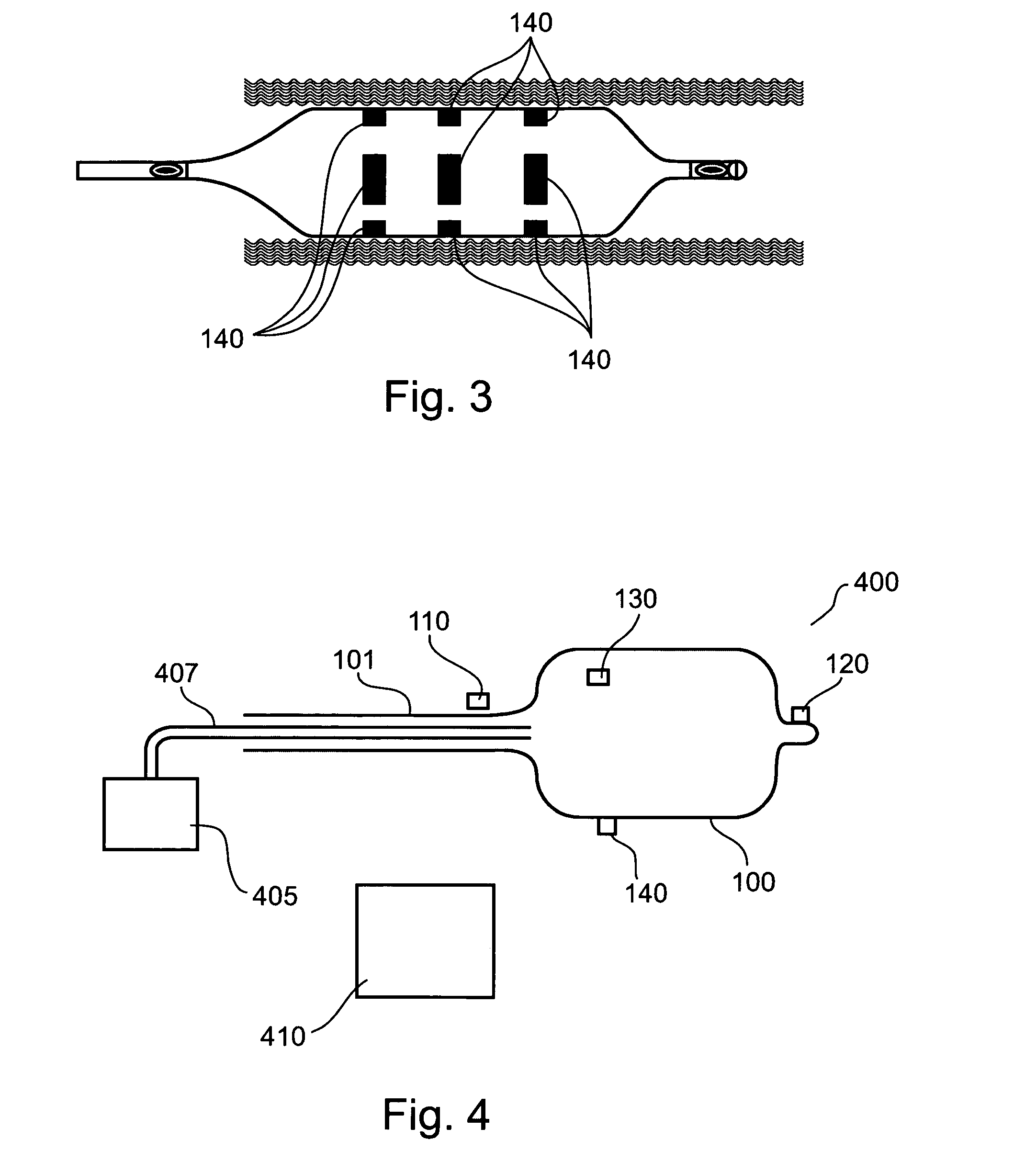 Device, system, and method for detecting, localizing, and characterizing plaque-induced stenosis of a blood vessel