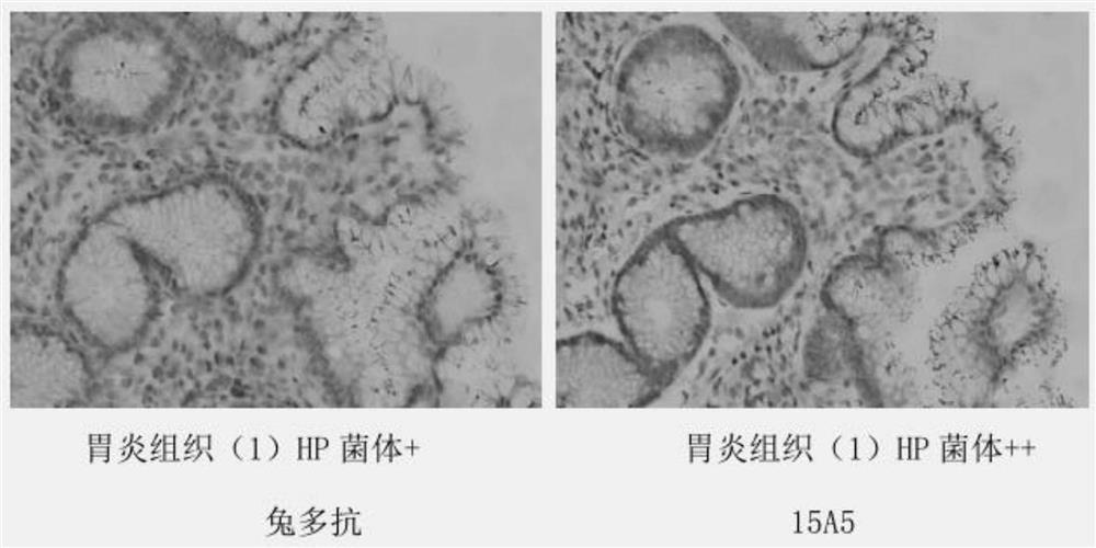 Anti-helicobacter pylori protein monoclonal antibody and its cell line, preparation method and application