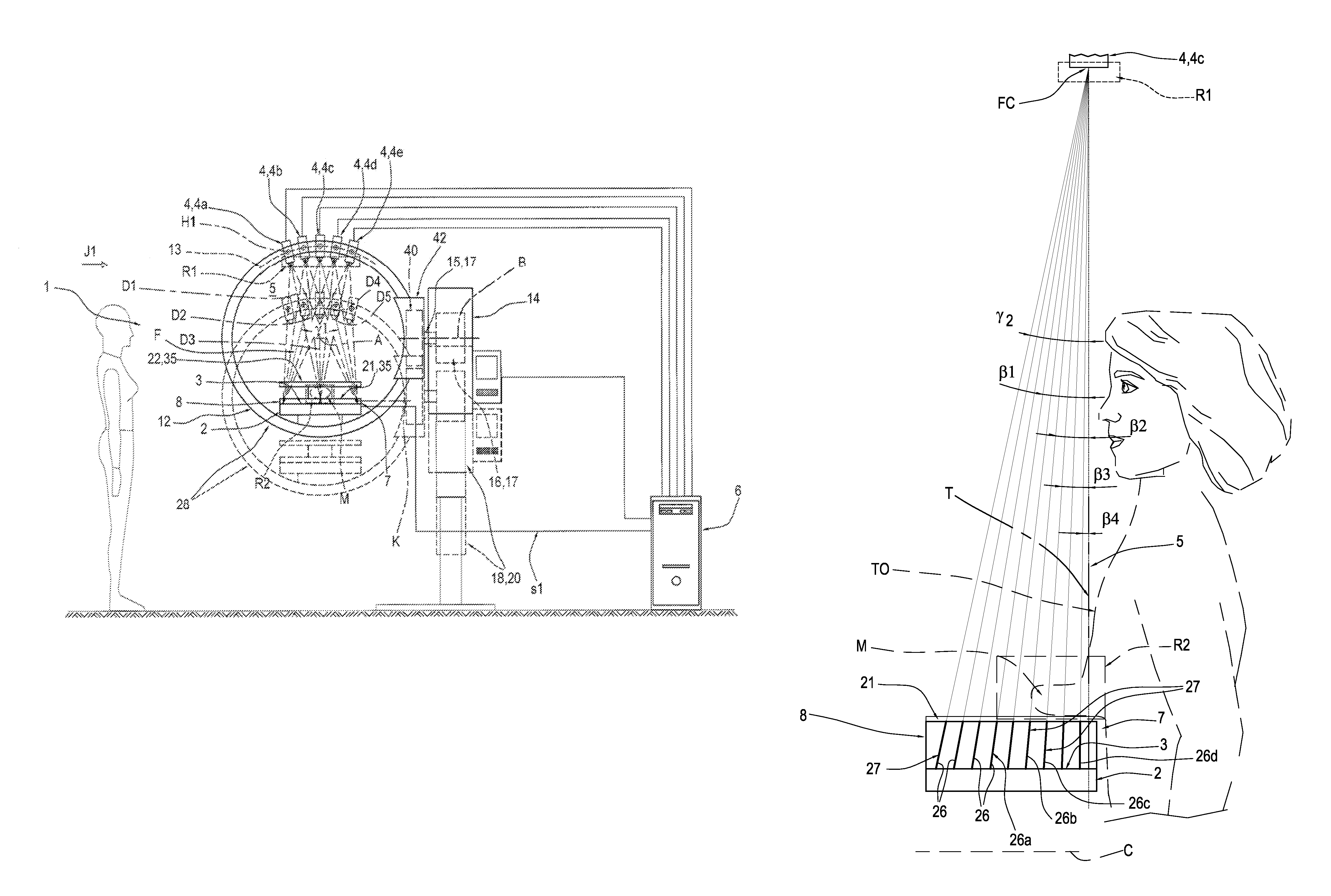 Apparatus for mammography and/or tomosynthesis with device for removing diffuse radiation