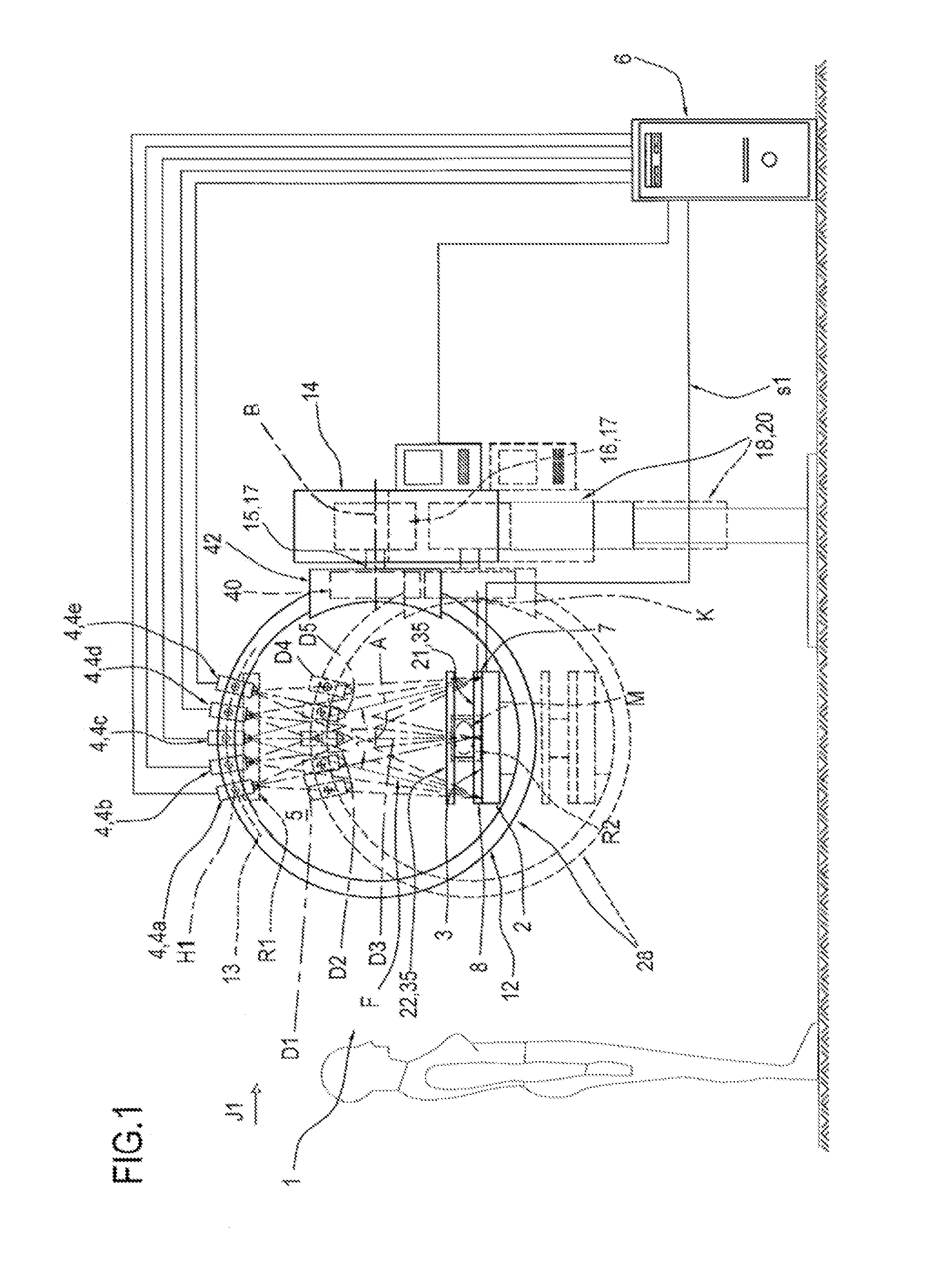 Apparatus for mammography and/or tomosynthesis with device for removing diffuse radiation