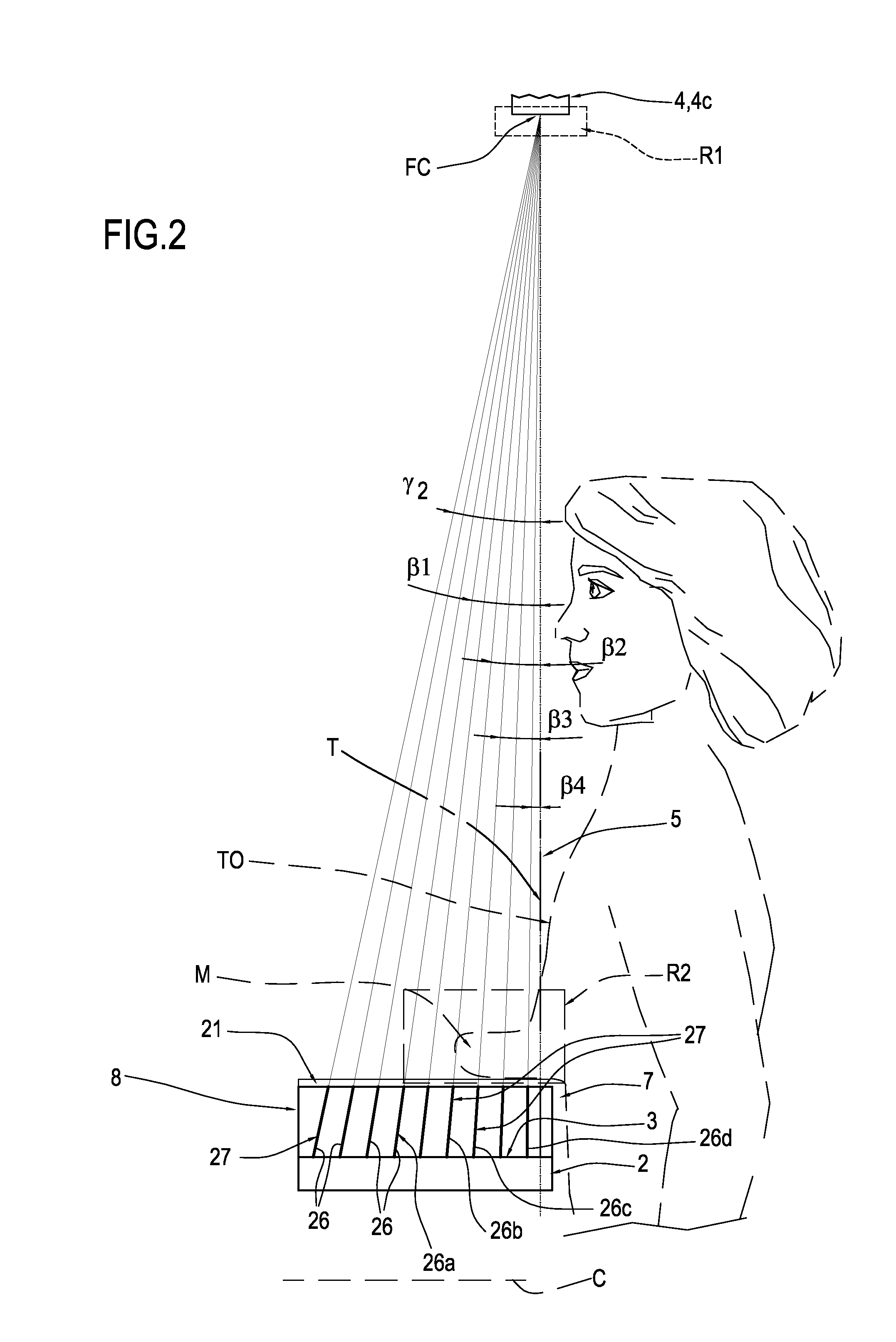 Apparatus for mammography and/or tomosynthesis with device for removing diffuse radiation