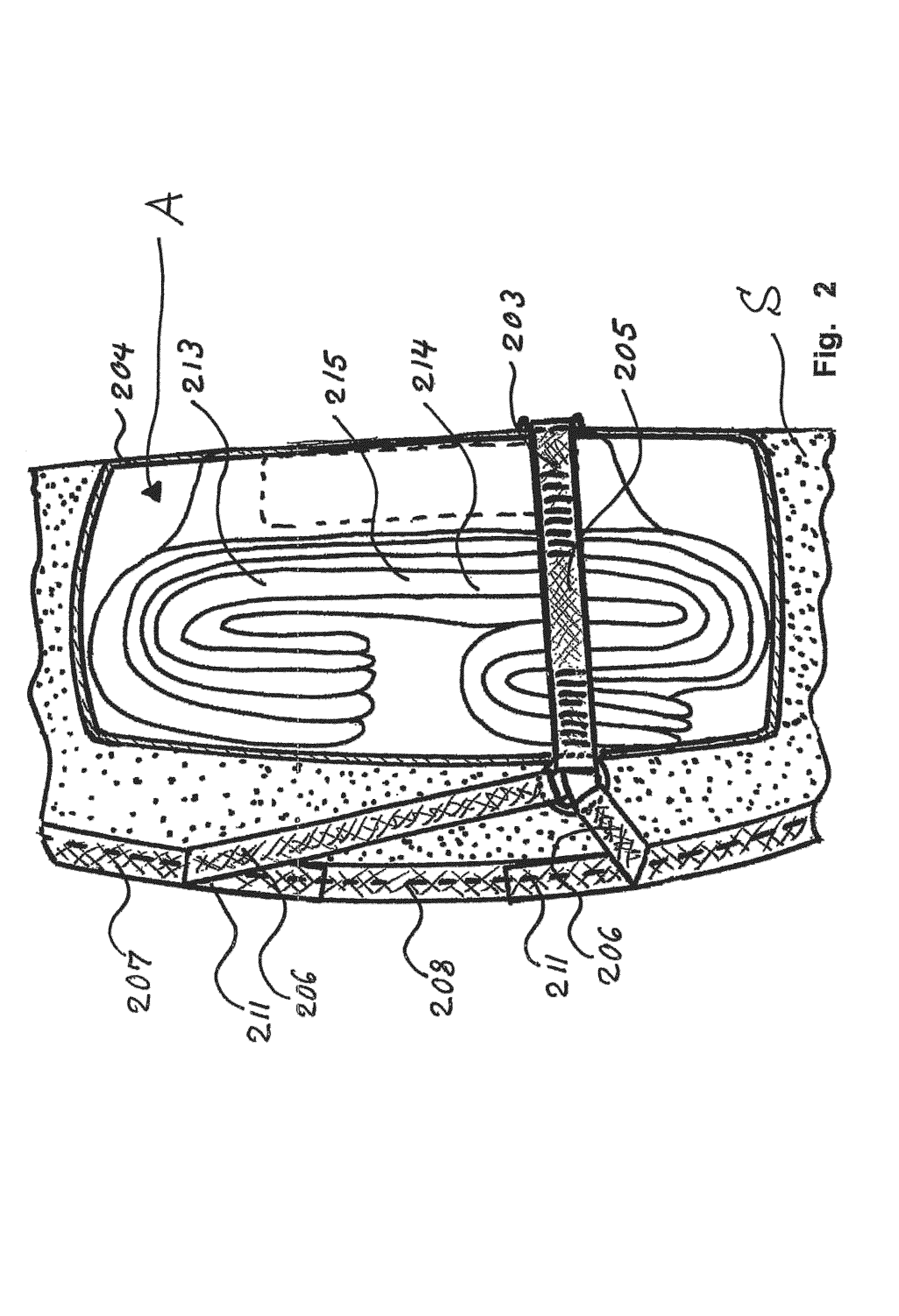 Airbag system, vehicle seat comprising an airbag system, and deployment for an airbag system