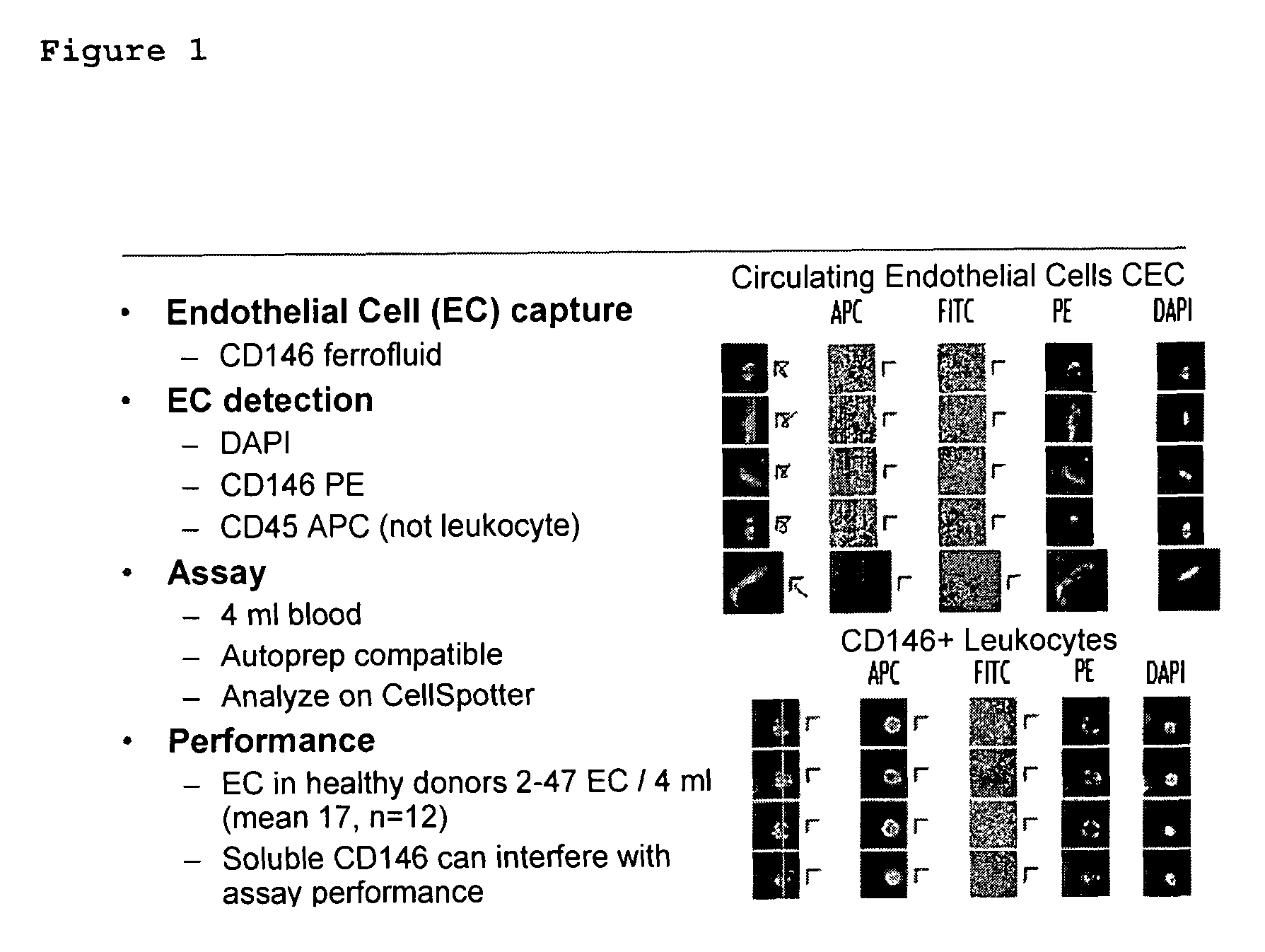 Method for assessing disease states by profile analysis of isolated circulating endothelial cells
