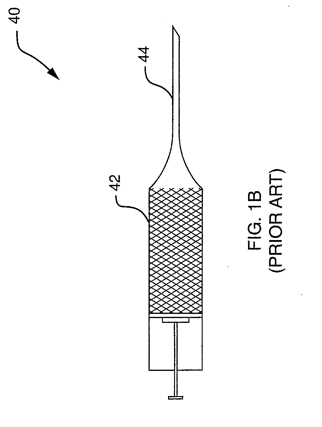 Remotely-activated vertebroplasty injection device