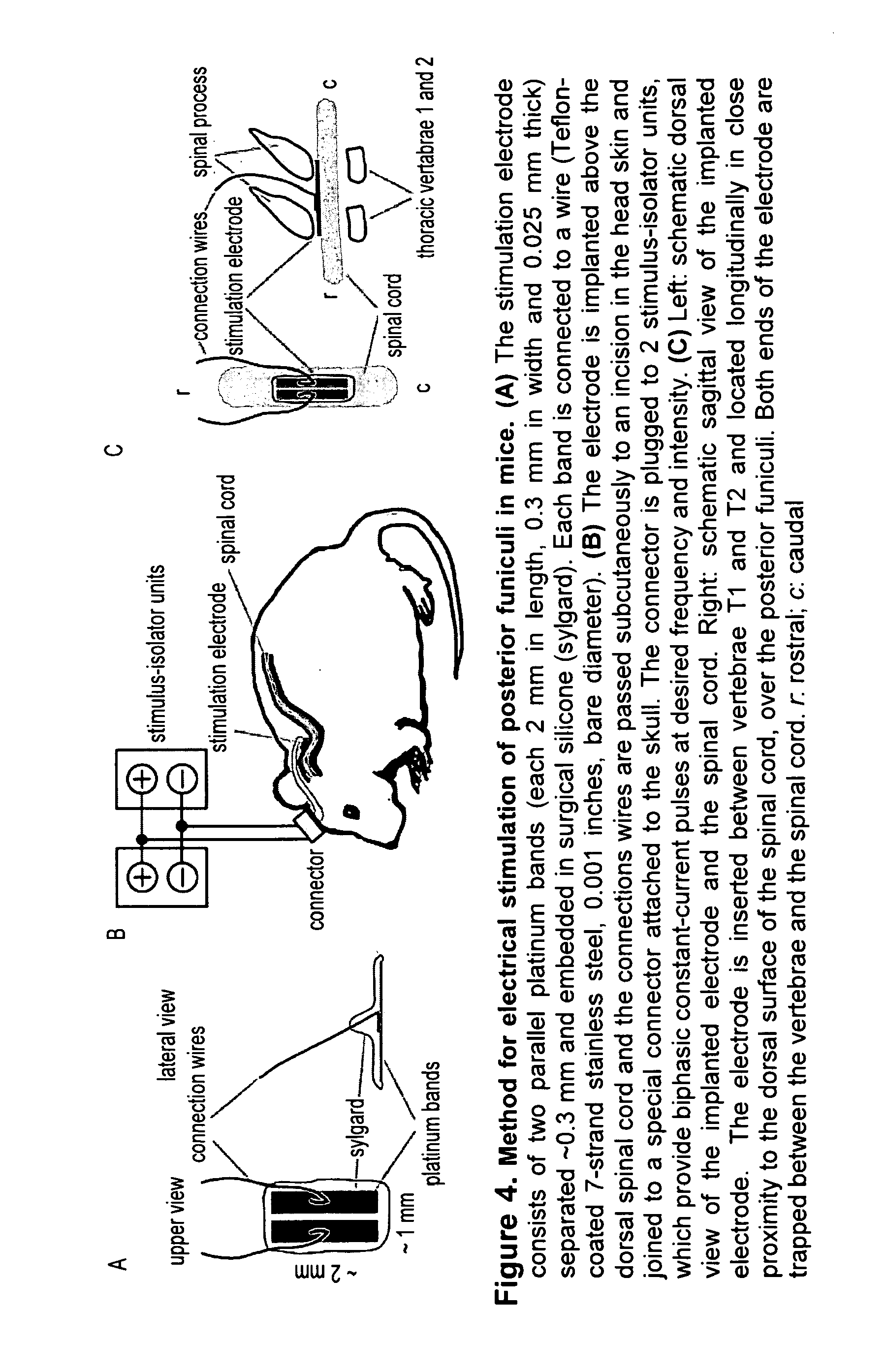 Method of treating parkinson's disease and other movement disorders