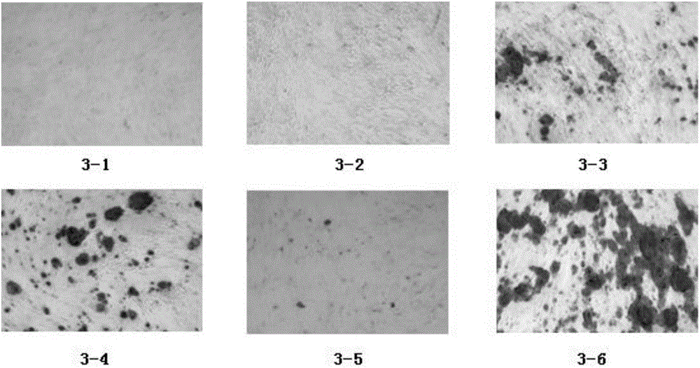 Adipose-derived mesenchymal stem cell osteogenic induction composition and osteogenic induction method thereof