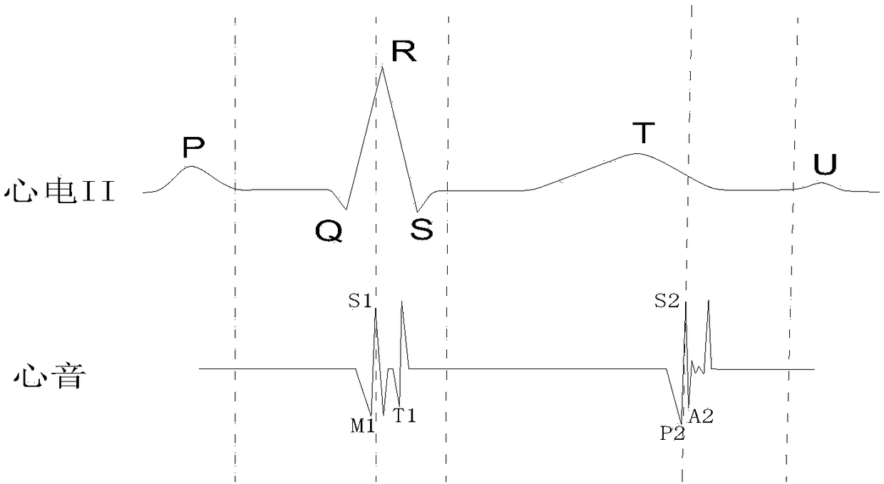 Positioning analysis method for electrocardiogram and phonocardiogram based on cardiac sound characteristics