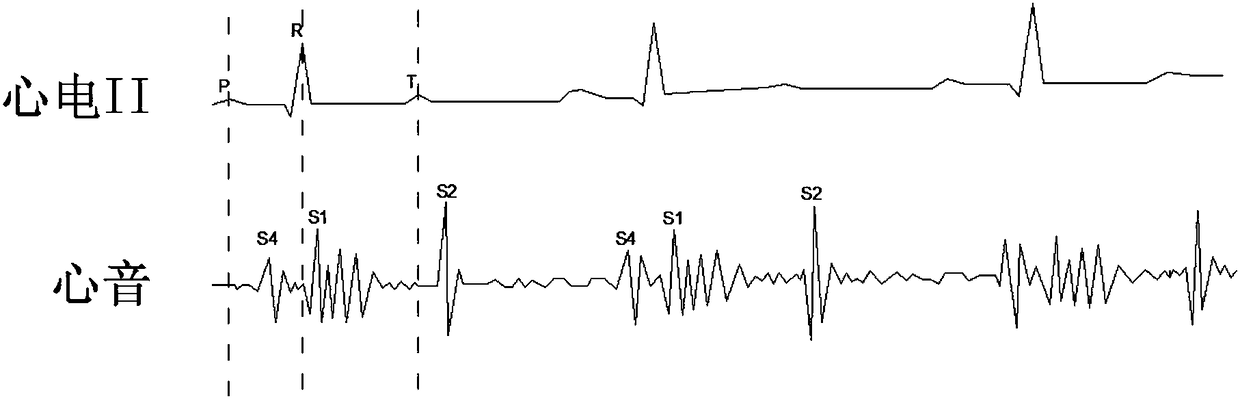 Positioning analysis method for electrocardiogram and phonocardiogram based on cardiac sound characteristics