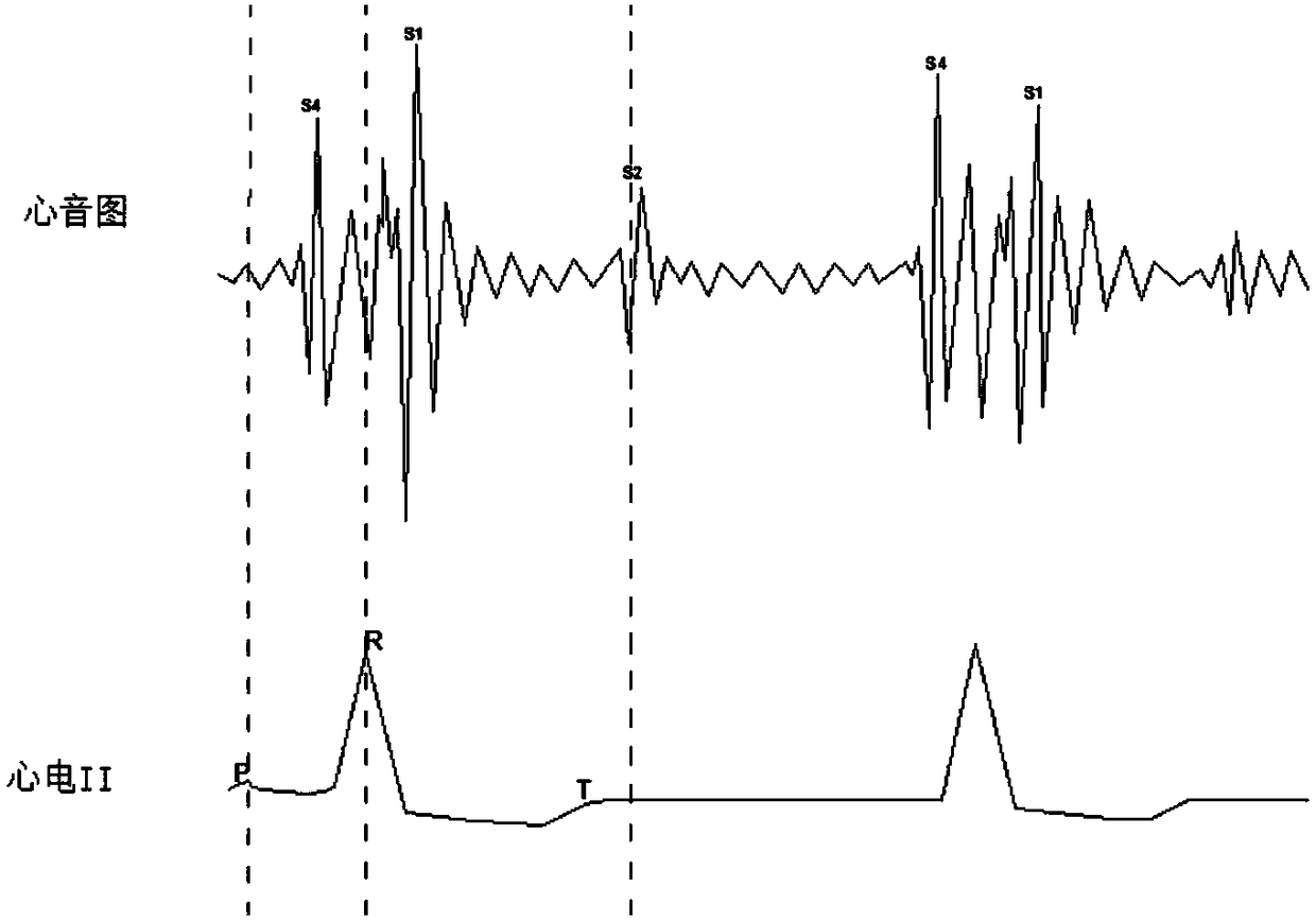 Positioning analysis method for electrocardiogram and phonocardiogram based on cardiac sound characteristics