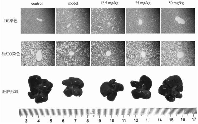 Application of herpetrione extract in preparation of medicine for treating non-alcoholic fatty liver disease