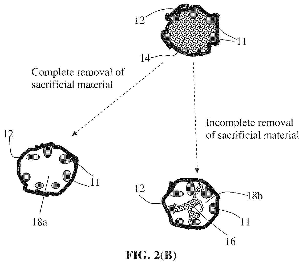 Porous particulates of graphene shell-protected alkali metal, electrodes, and alkali metal battery