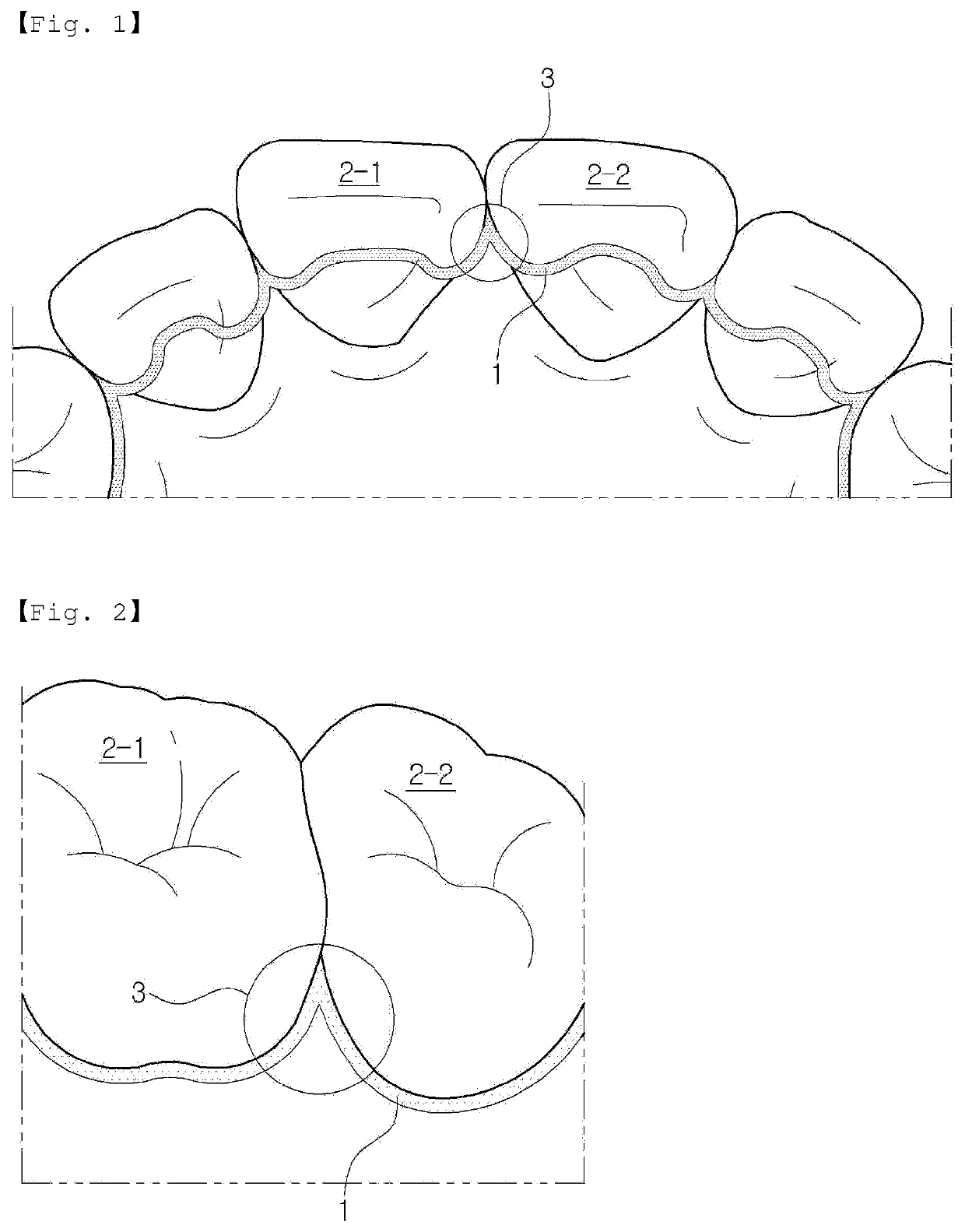 Retainer for maintaining teeth alignment of wearer