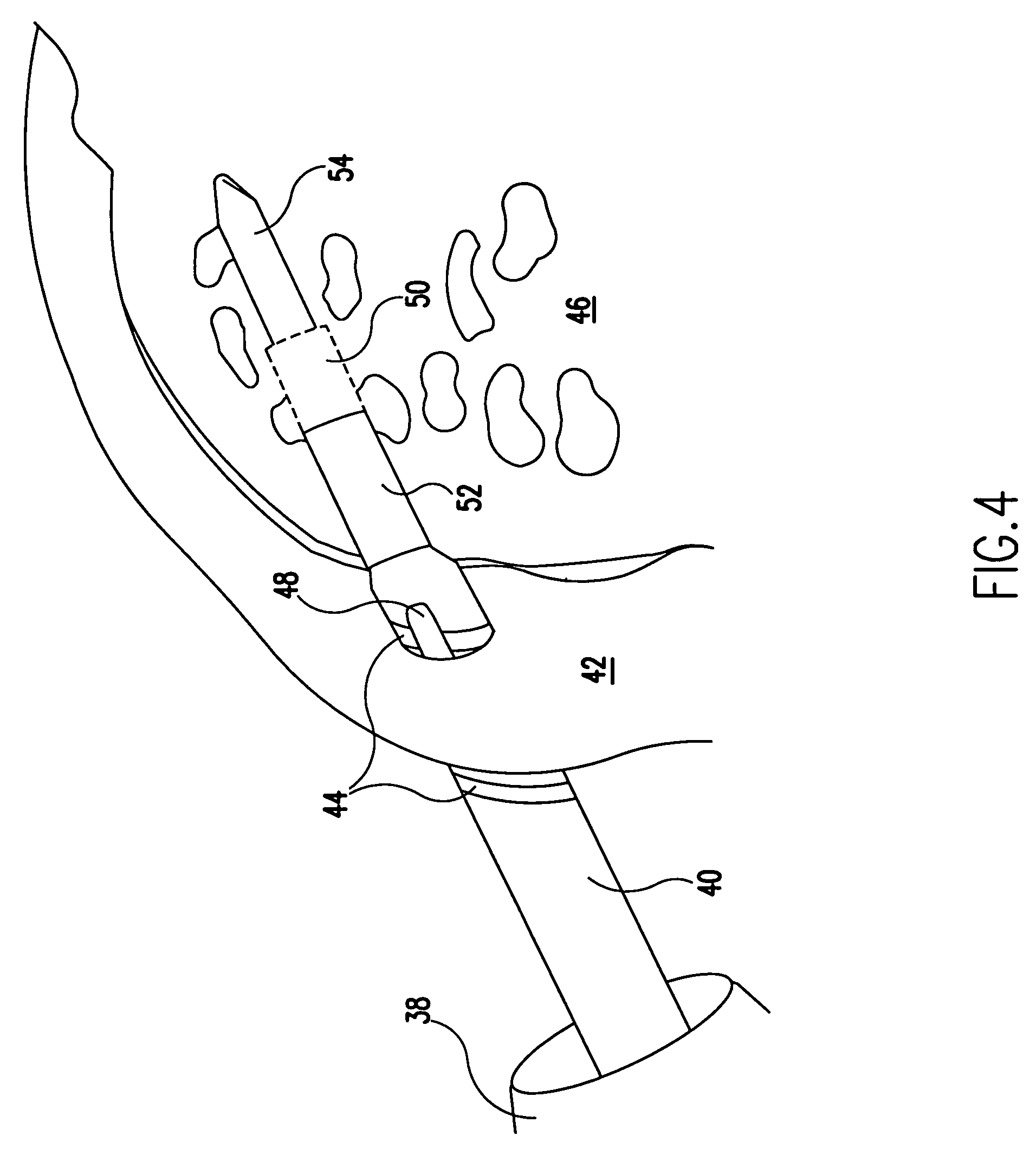 Bioabsorbable tissue tack with oval-shaped head and method of tissue fixation using the same