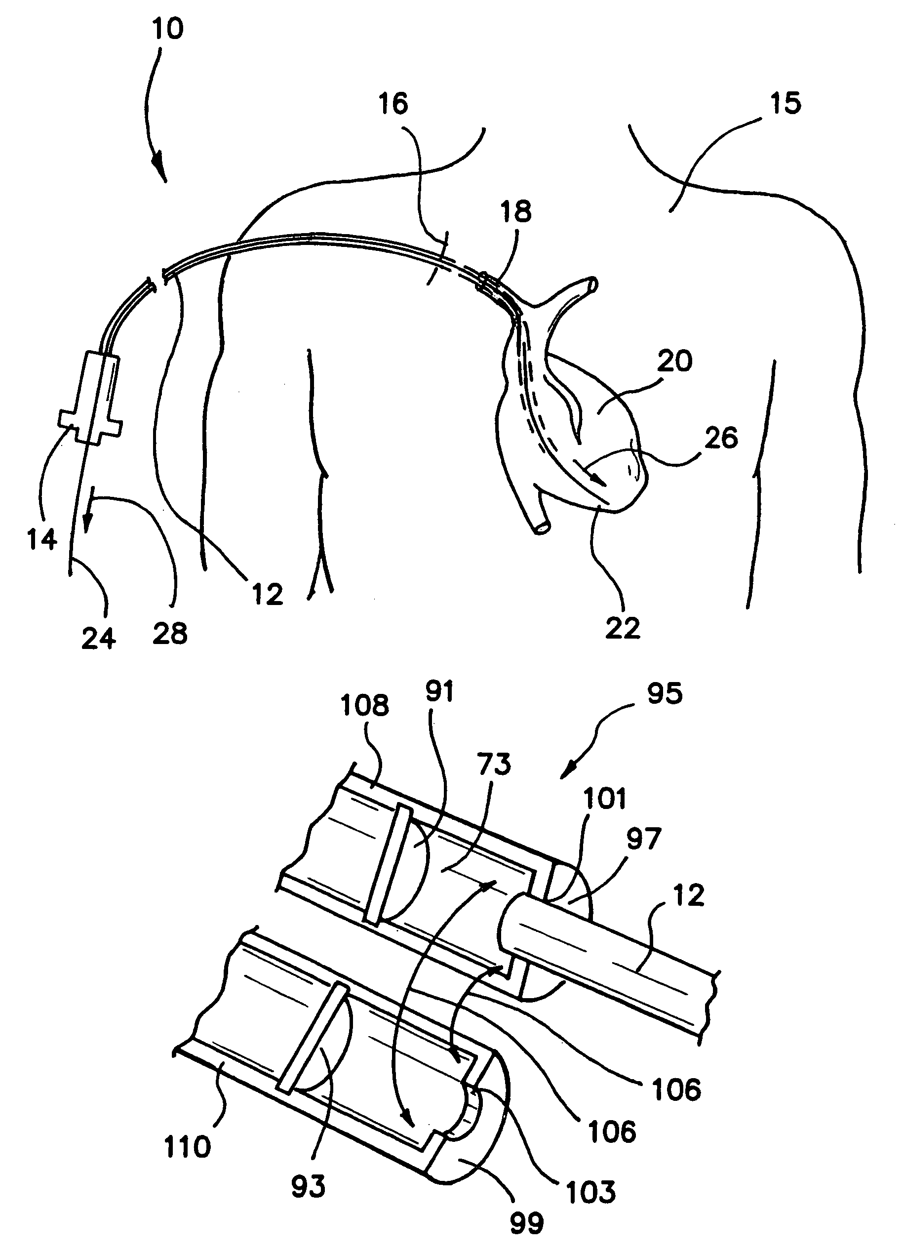 Introducer and hemostatic valve combination and method of using the same