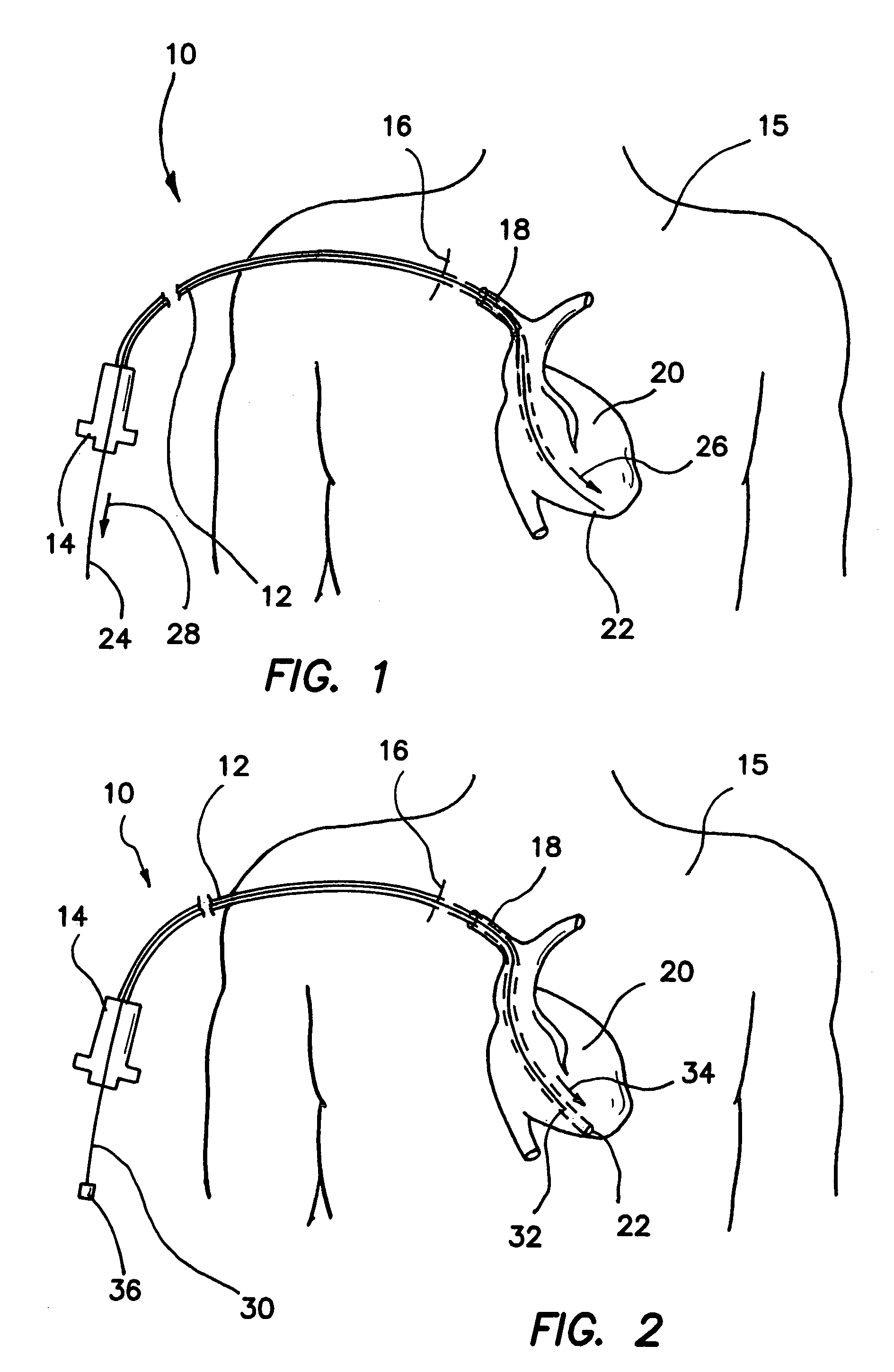 Introducer and hemostatic valve combination and method of using the same