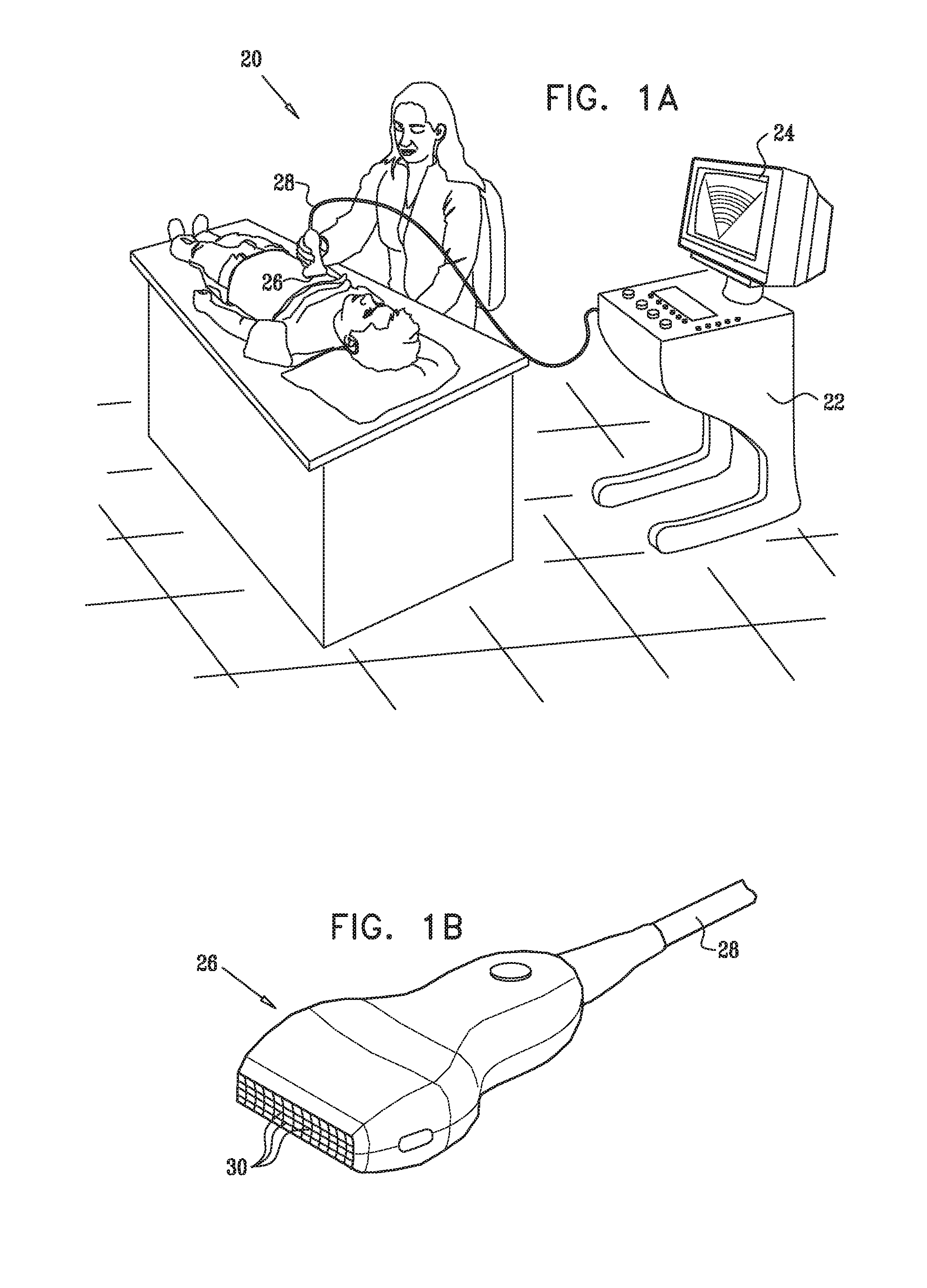 Clutter suppression in ultrasonic imaging systems