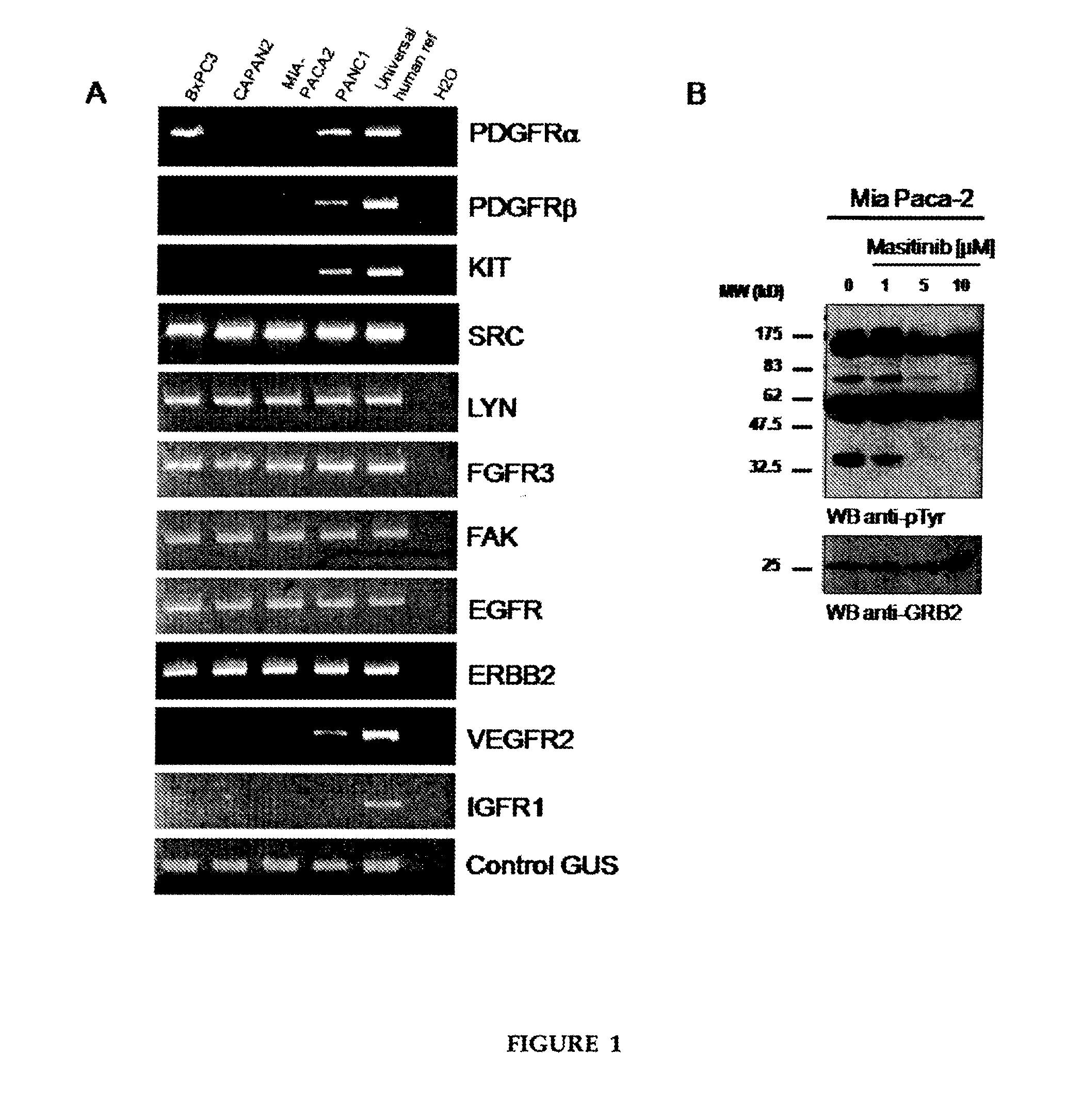 Combined treatment of pancreatic cancer with gemcitabine and masitinib