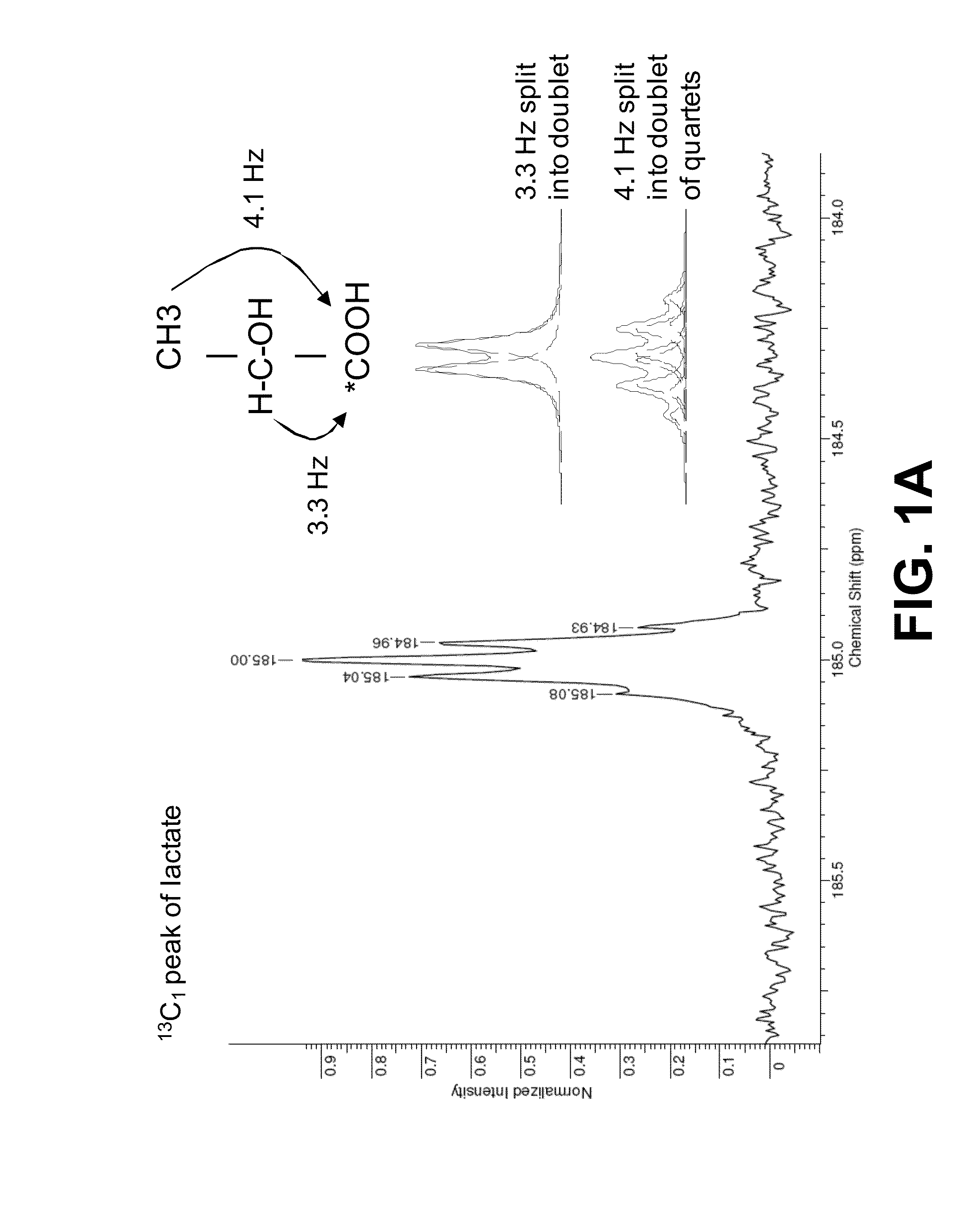 Hyperpolarized lactate contrast agent for determination of LDH activity