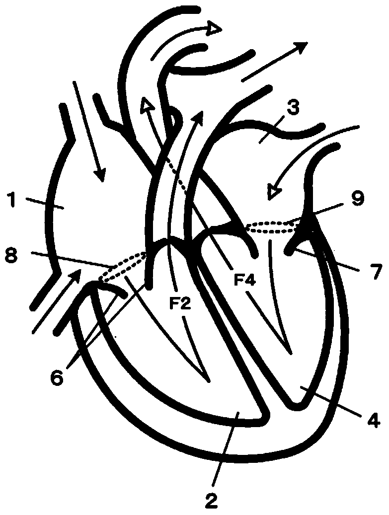 Left atrial pressure measurement method and left atrial pressure measurement device