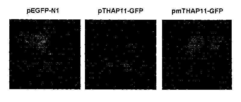 Novel human cell growth inhibiting gene THAP11 and application thereof