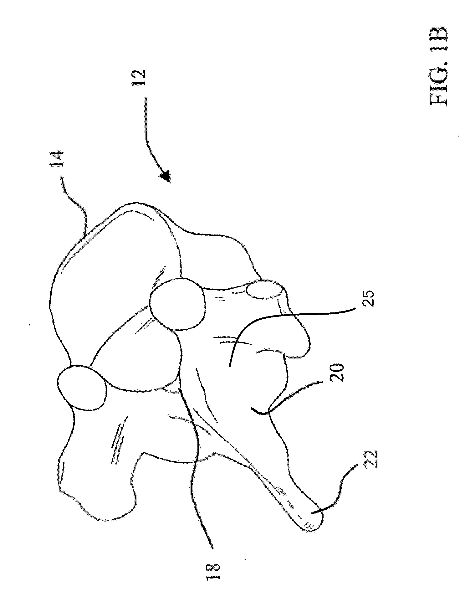Systems, devices and methods for stabilizing bone