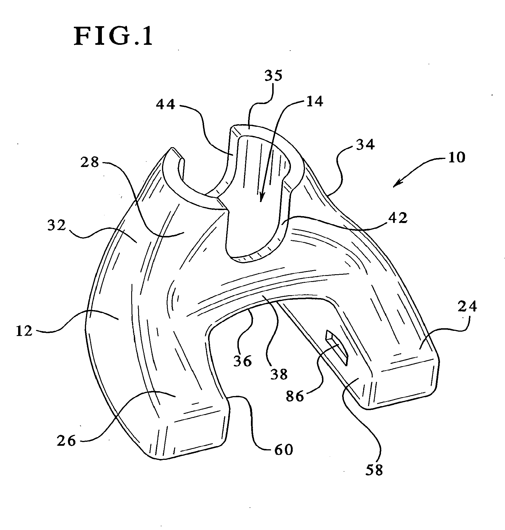 Femoral augments for use with knee joint prosthesis