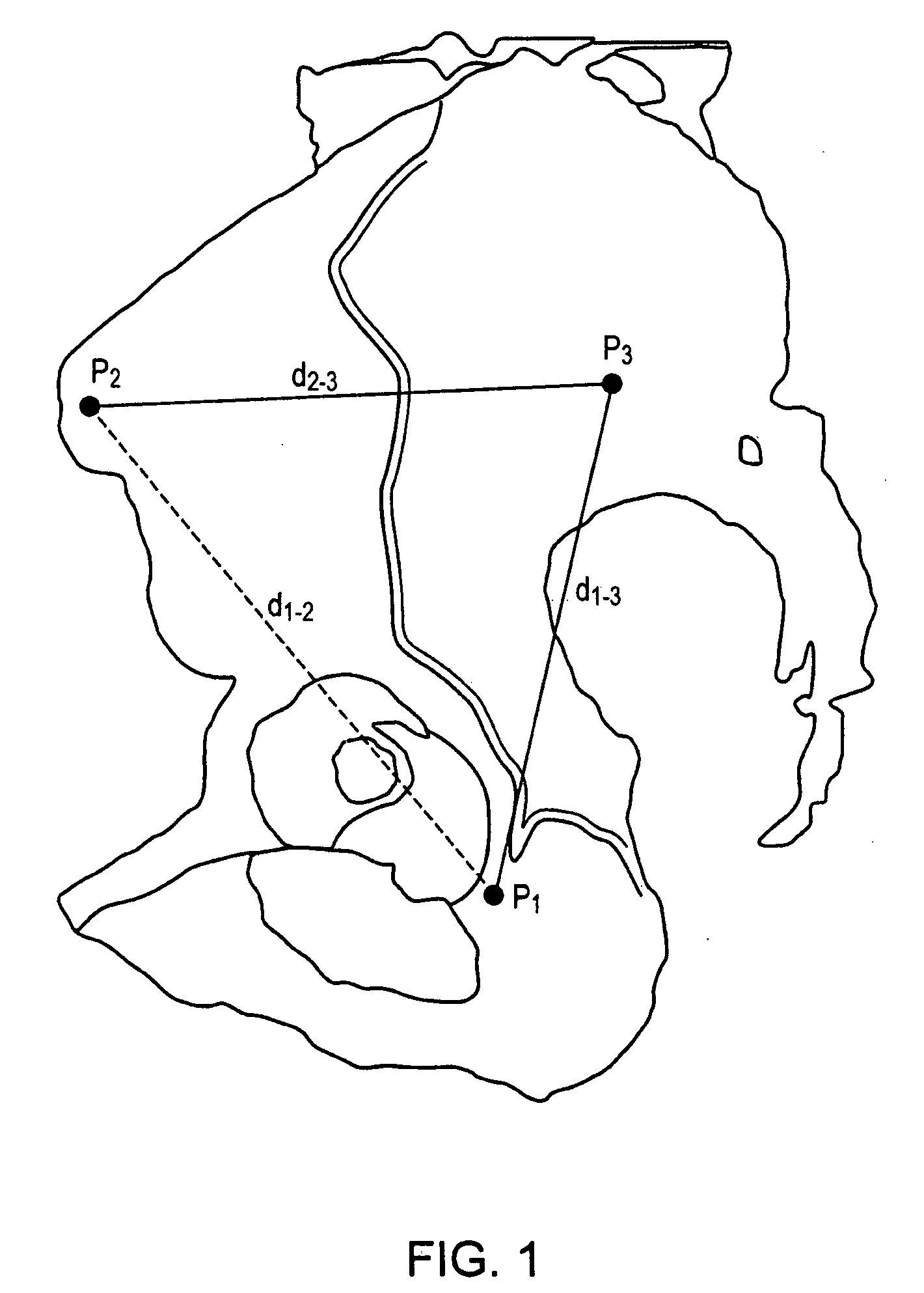 Method and apparatus for determining acetabular component positioning