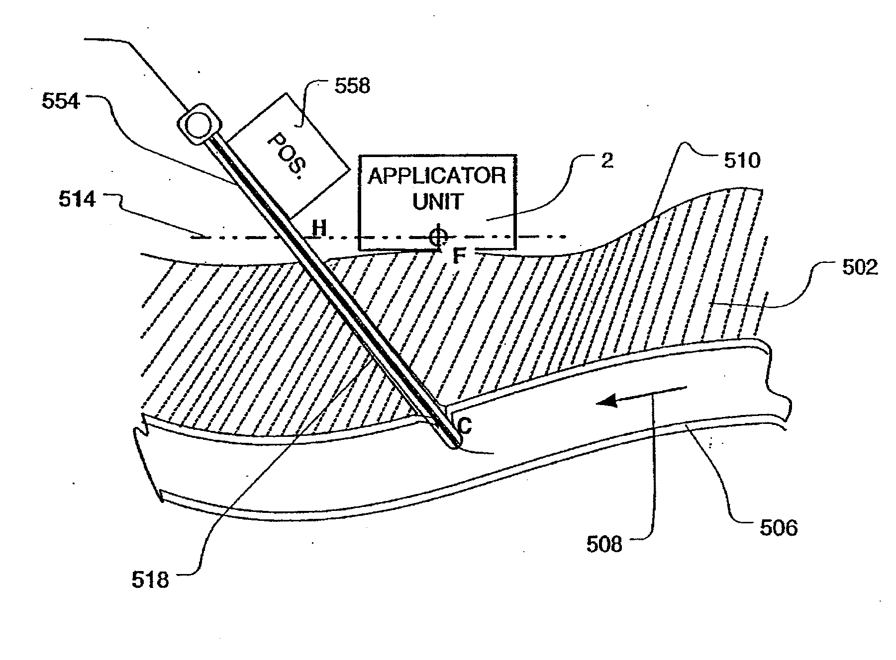 Methods and apparatus for focused ultrasound application