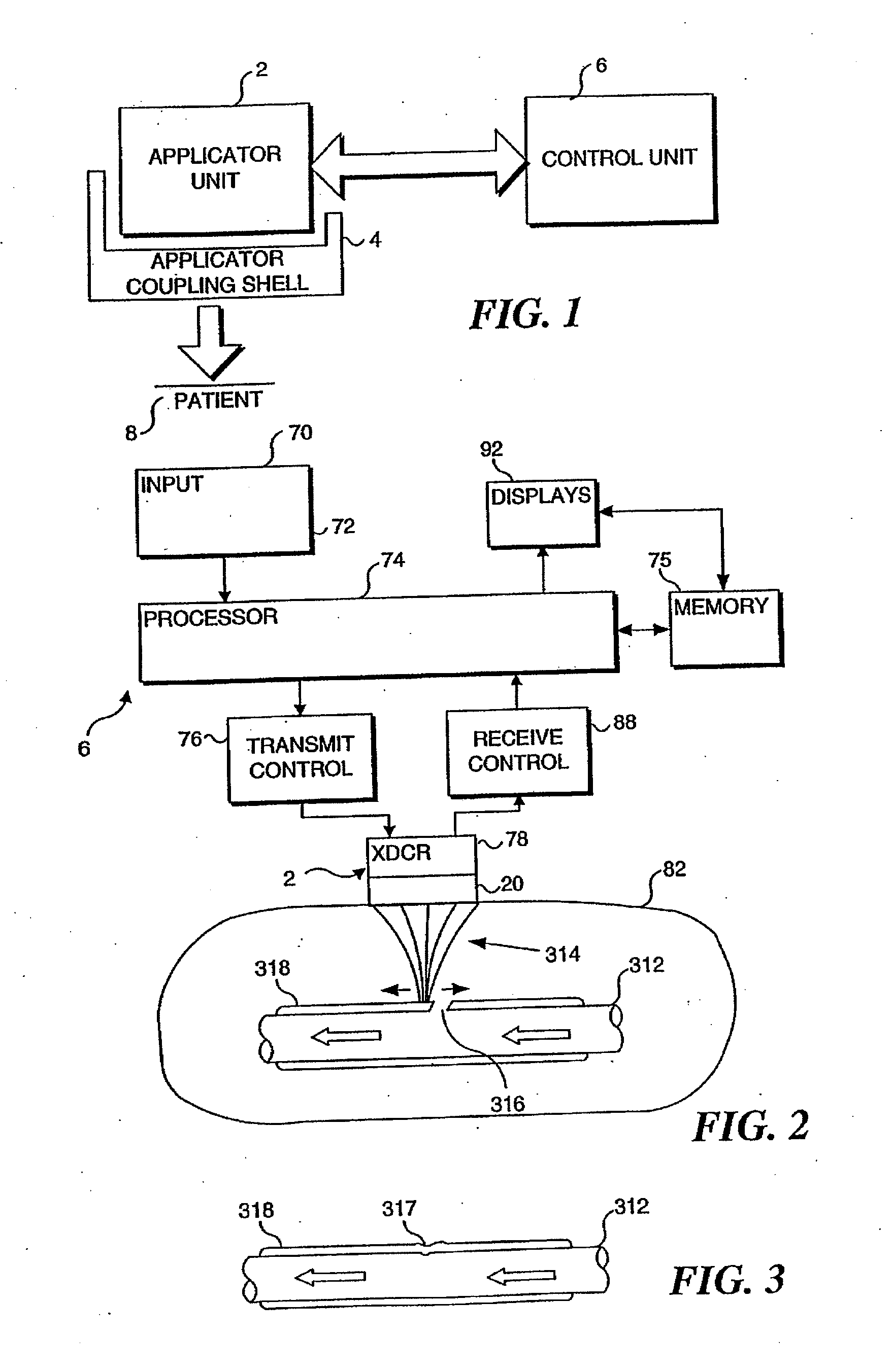 Methods and apparatus for focused ultrasound application