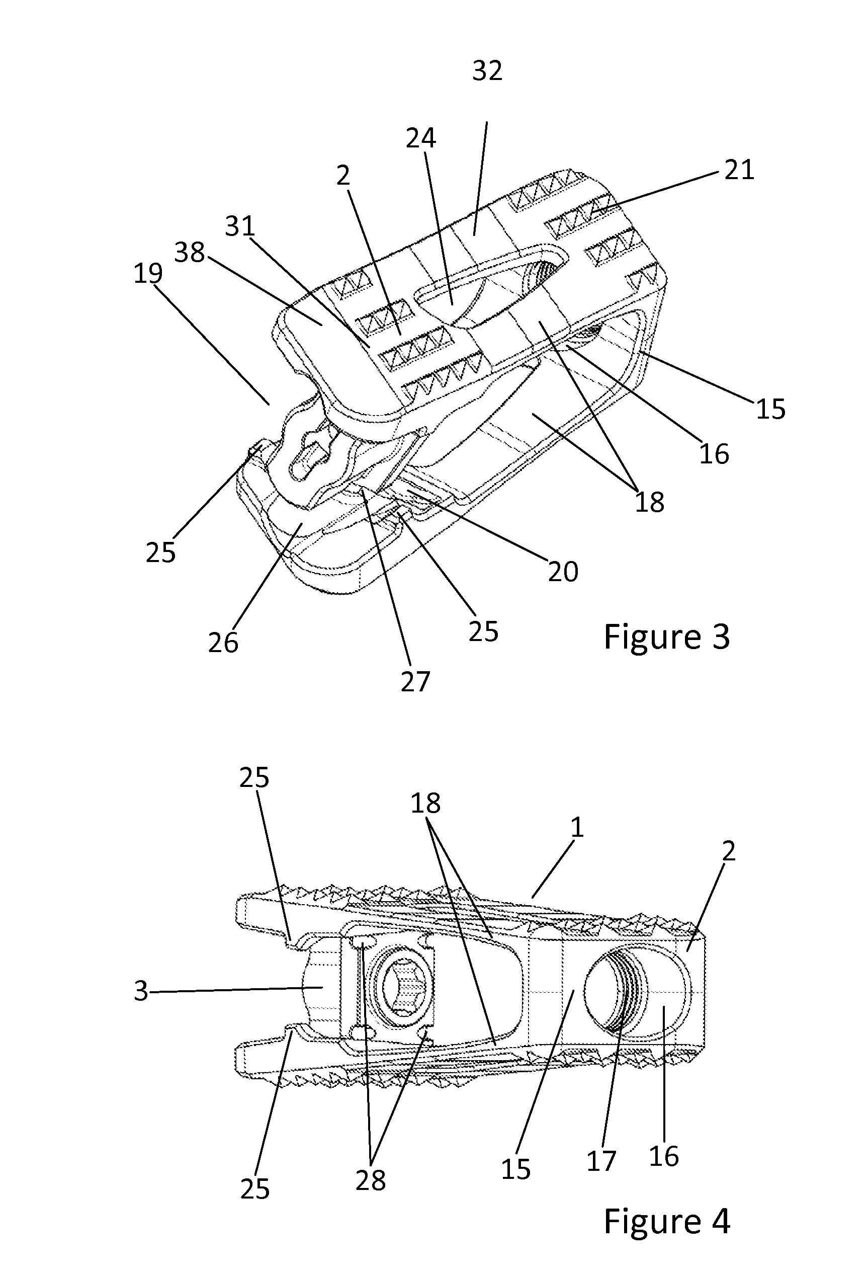 Expandable Cage for the Intercorporal Fusion of Lumbar Vertebrae