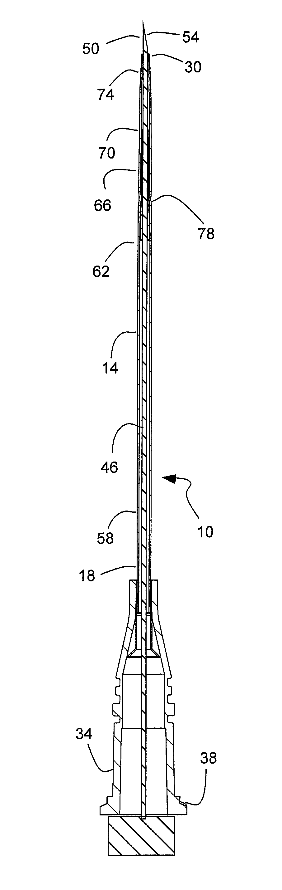 High-flow tapered peripheral iv catheter with side outlets