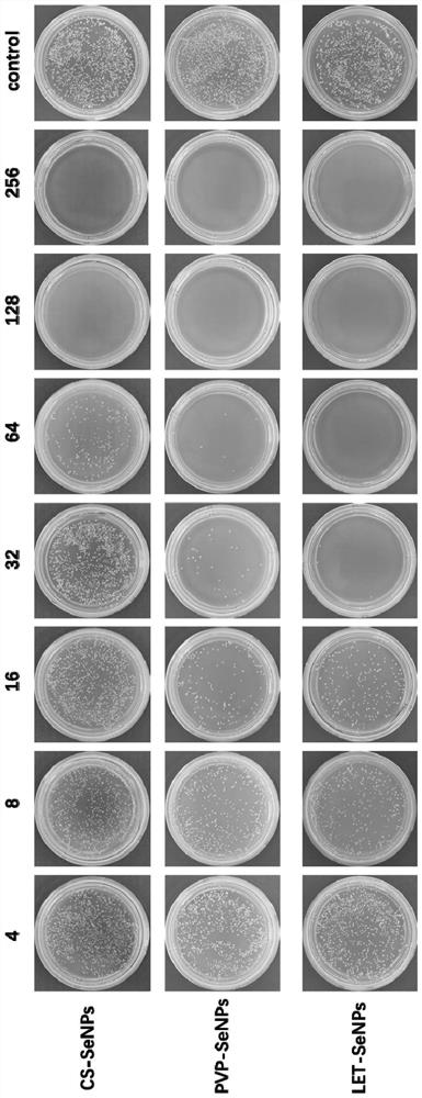 Application of functionalized nano-selenium in preparation of anti-wound infection drugs