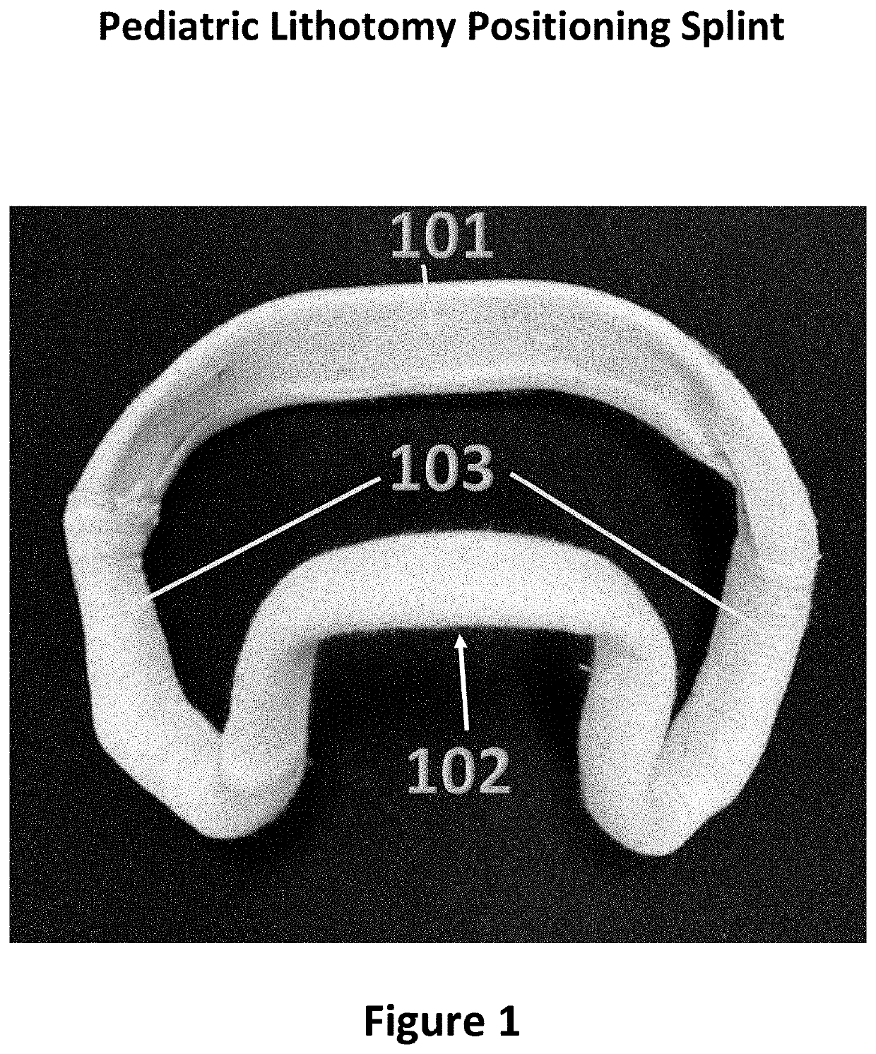 Pediatric lithotomy positioning splint