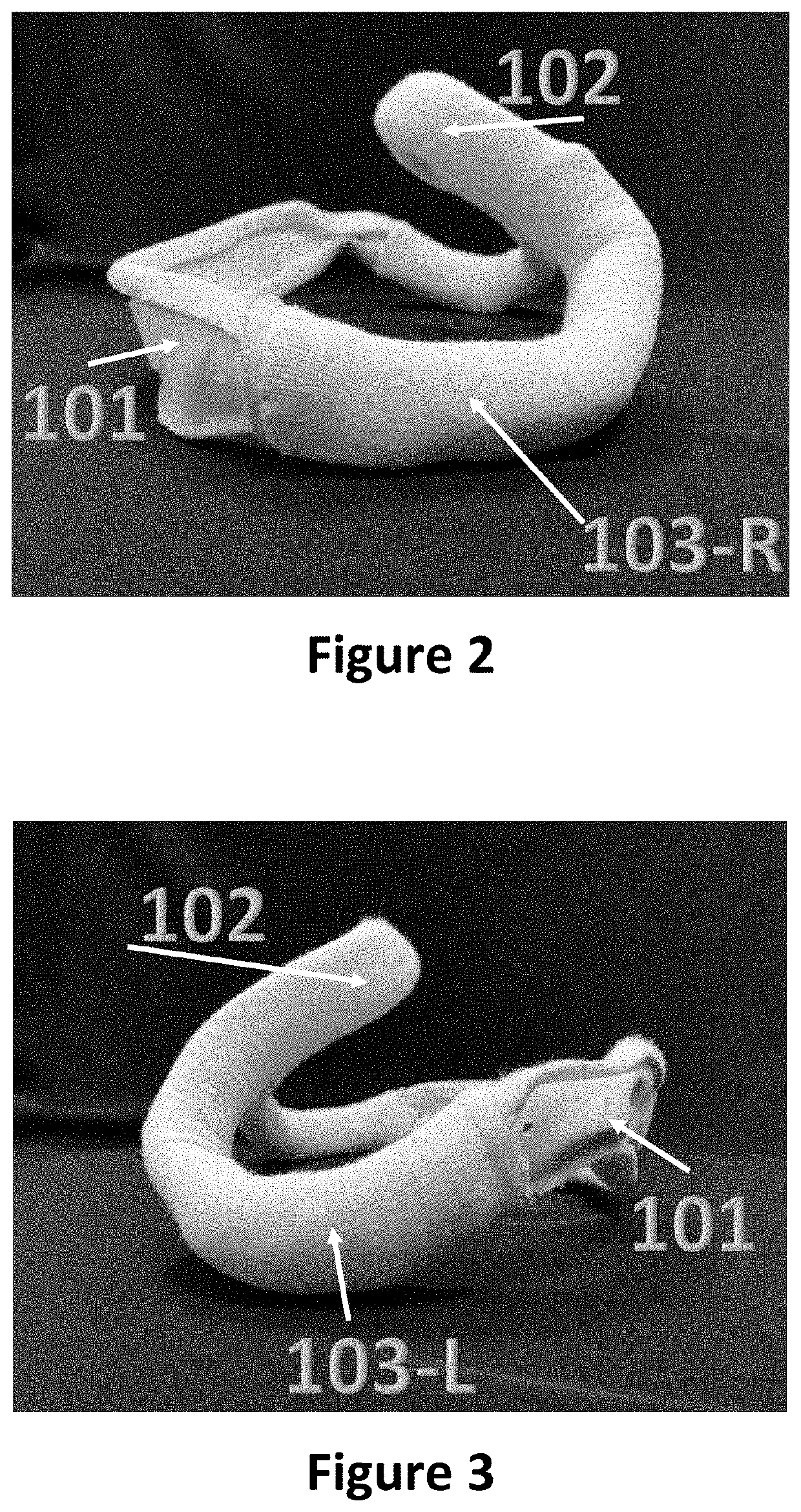 Pediatric lithotomy positioning splint