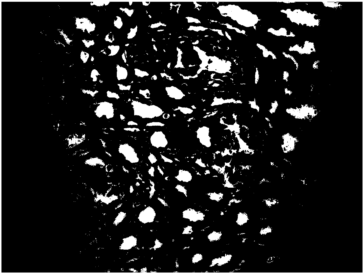 Traditional Chinese medicinal composition for preventing and treating urinary system diseases, and preparation method thereof