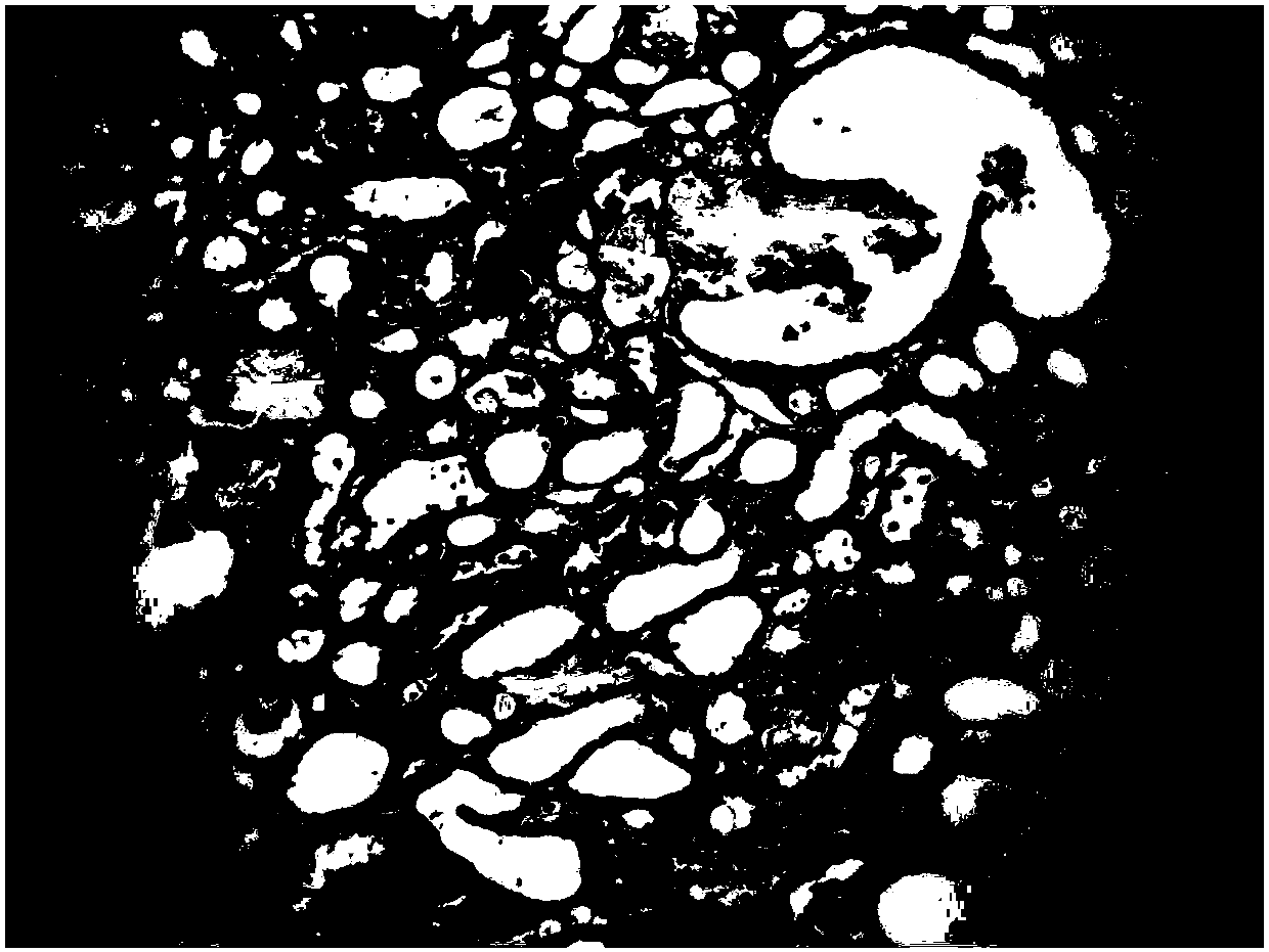 Traditional Chinese medicinal composition for preventing and treating urinary system diseases, and preparation method thereof