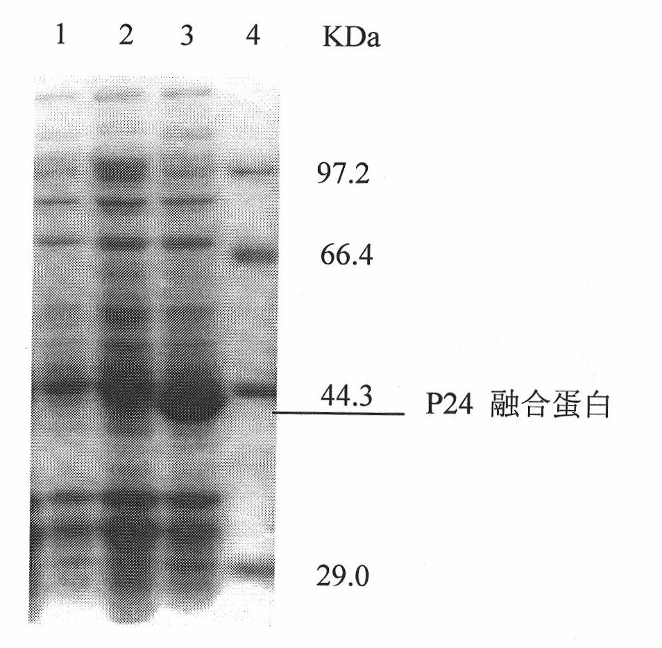 Monoclonal antibody hybridoma cell of HIV P24 and application
