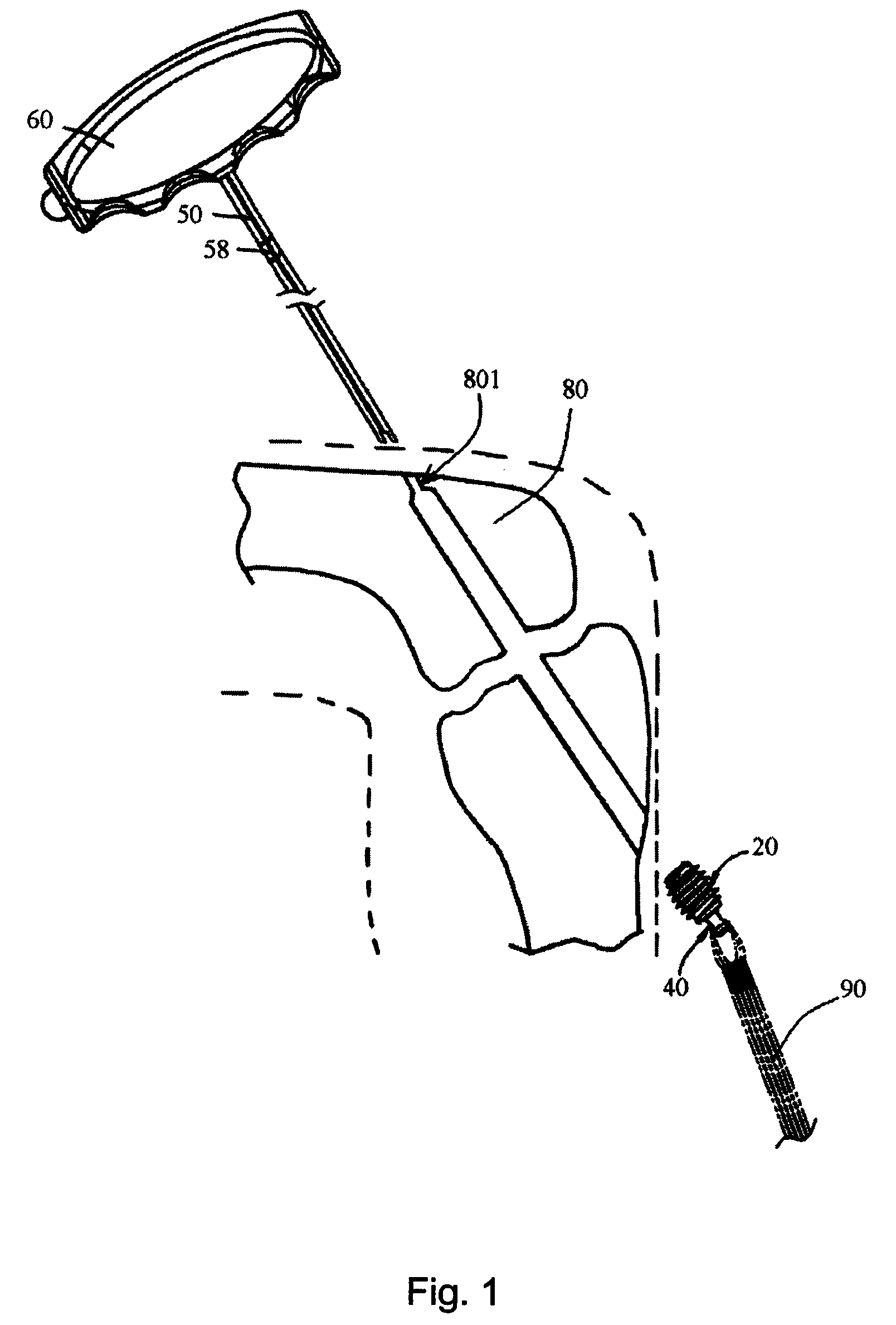 Graft attachment device for ligament reconstruction