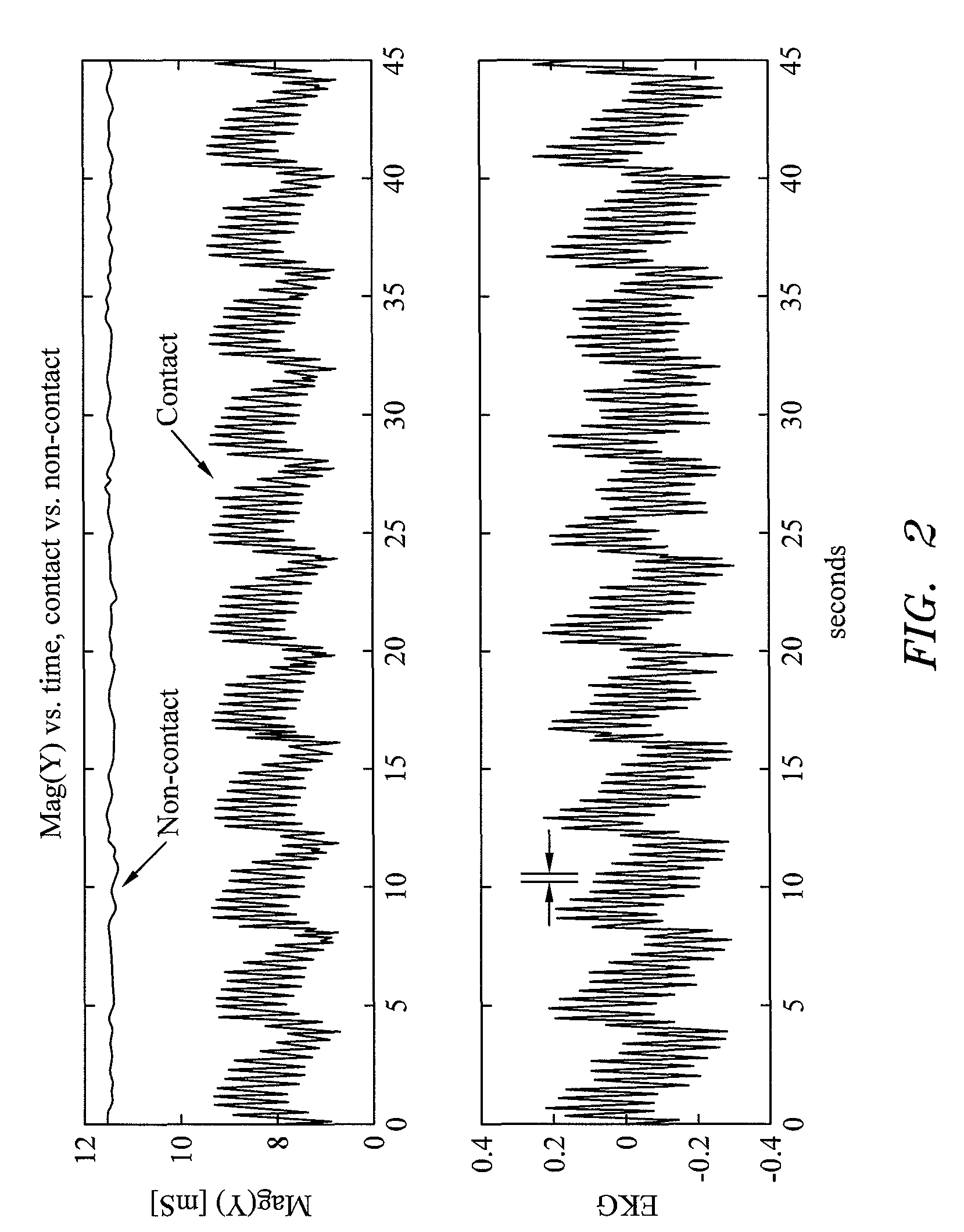 System and method for determining electrode-tissue contact based on amplitude modulation of sensed signal
