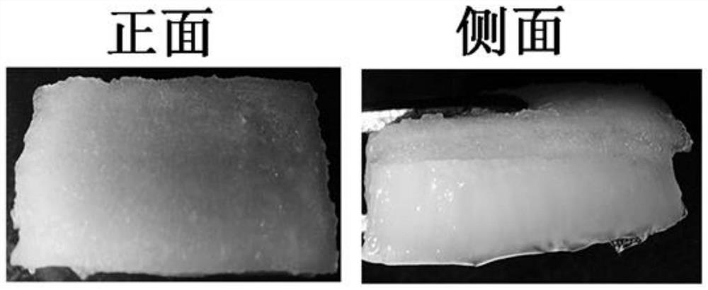 Imbibition controlled-release antibacterial peptide hydrogel double-layer dressing as well as preparation method and application thereof