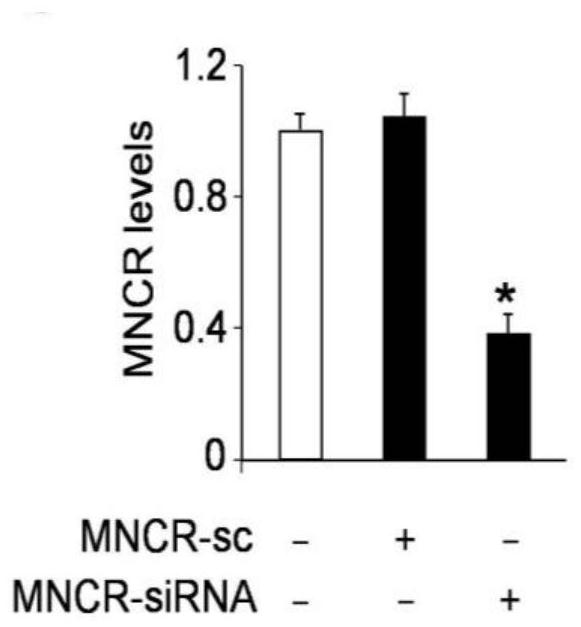 The role of circRNA MNCR in regulating cardiomyocyte necrosis and myocardial ischemia injury