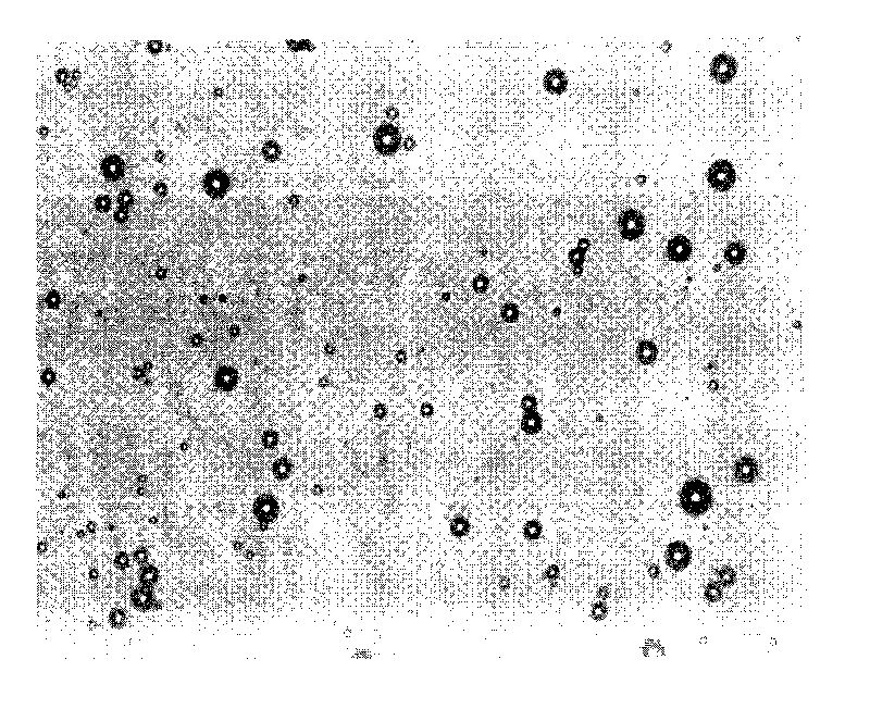 Method for preparing medicine-carrying microvesicle
