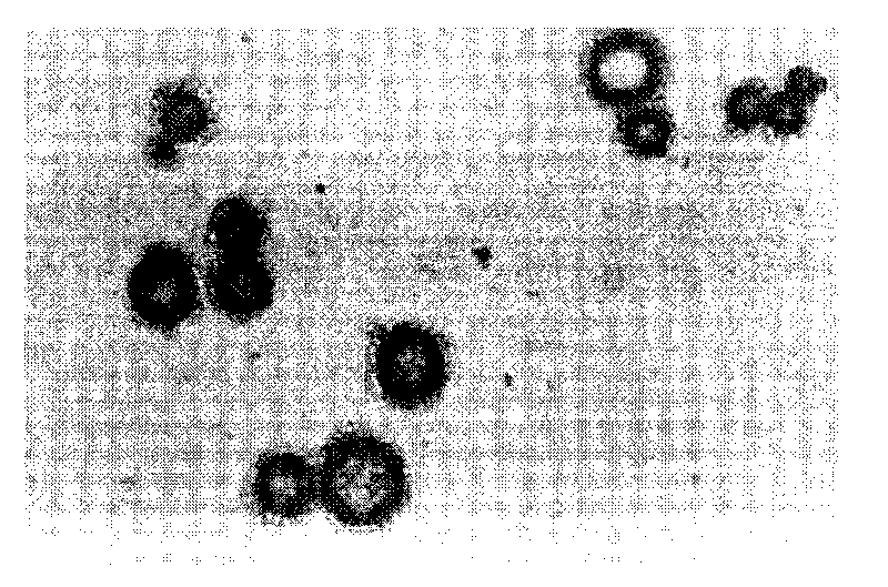 Method for preparing medicine-carrying microvesicle