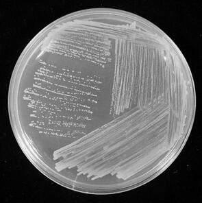 A kind of Burkholderia and its application