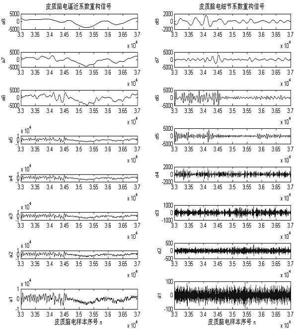 Intraoperative motion area function locating system based on electroencephalogram slow cortex potential wavelet analysis