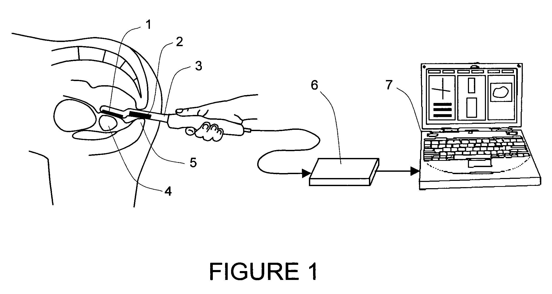 Method and a dual-array transducer probe for real time mechanical imaging of prostate
