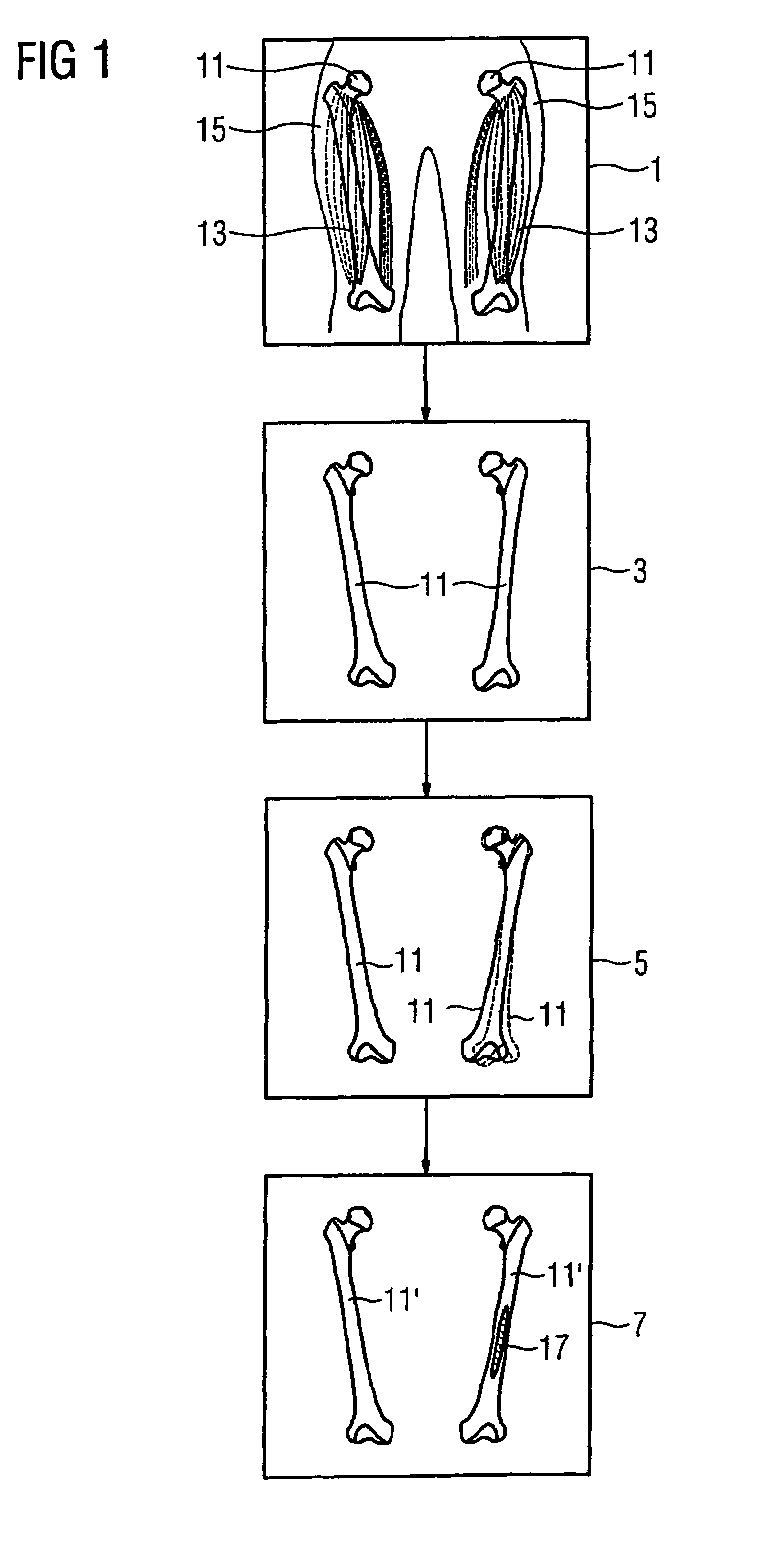 Method and apparatus for evaluating a 3D image of a laterally-symmetric organ system