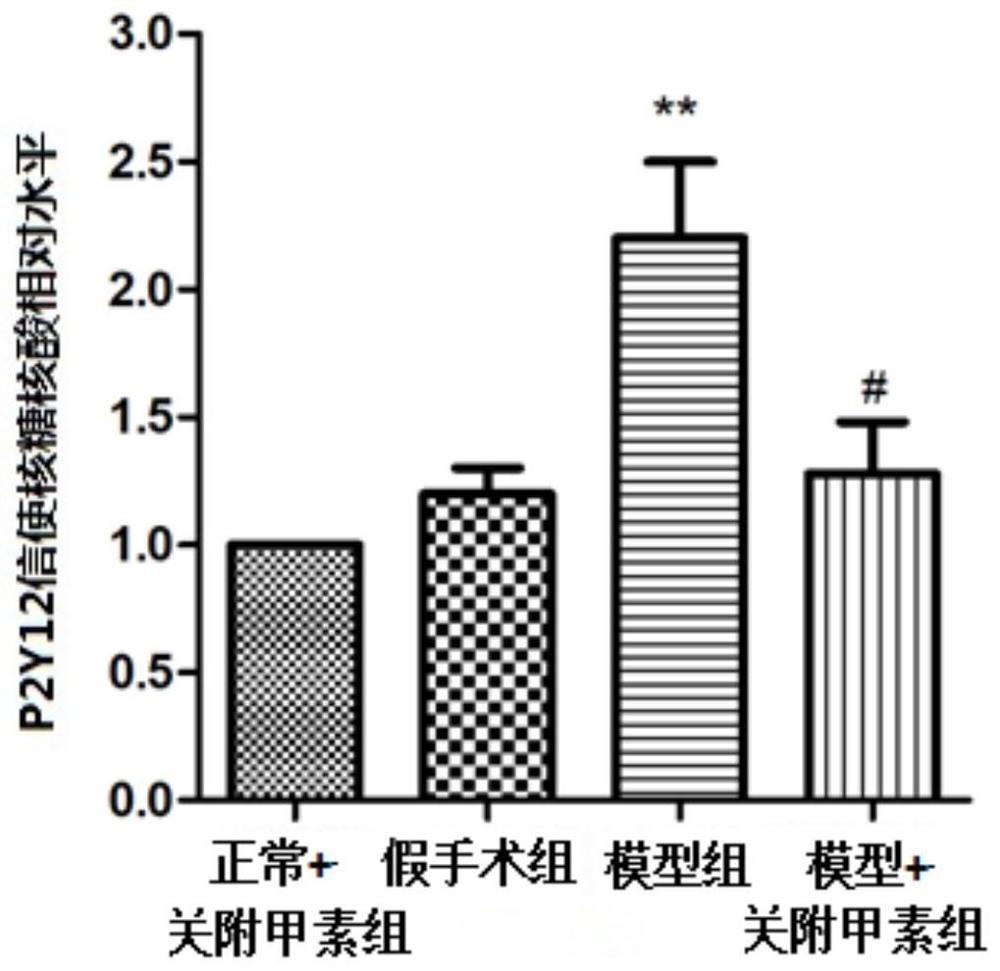 Application of Guanfu A in the preparation of medicine for neuropathic pain