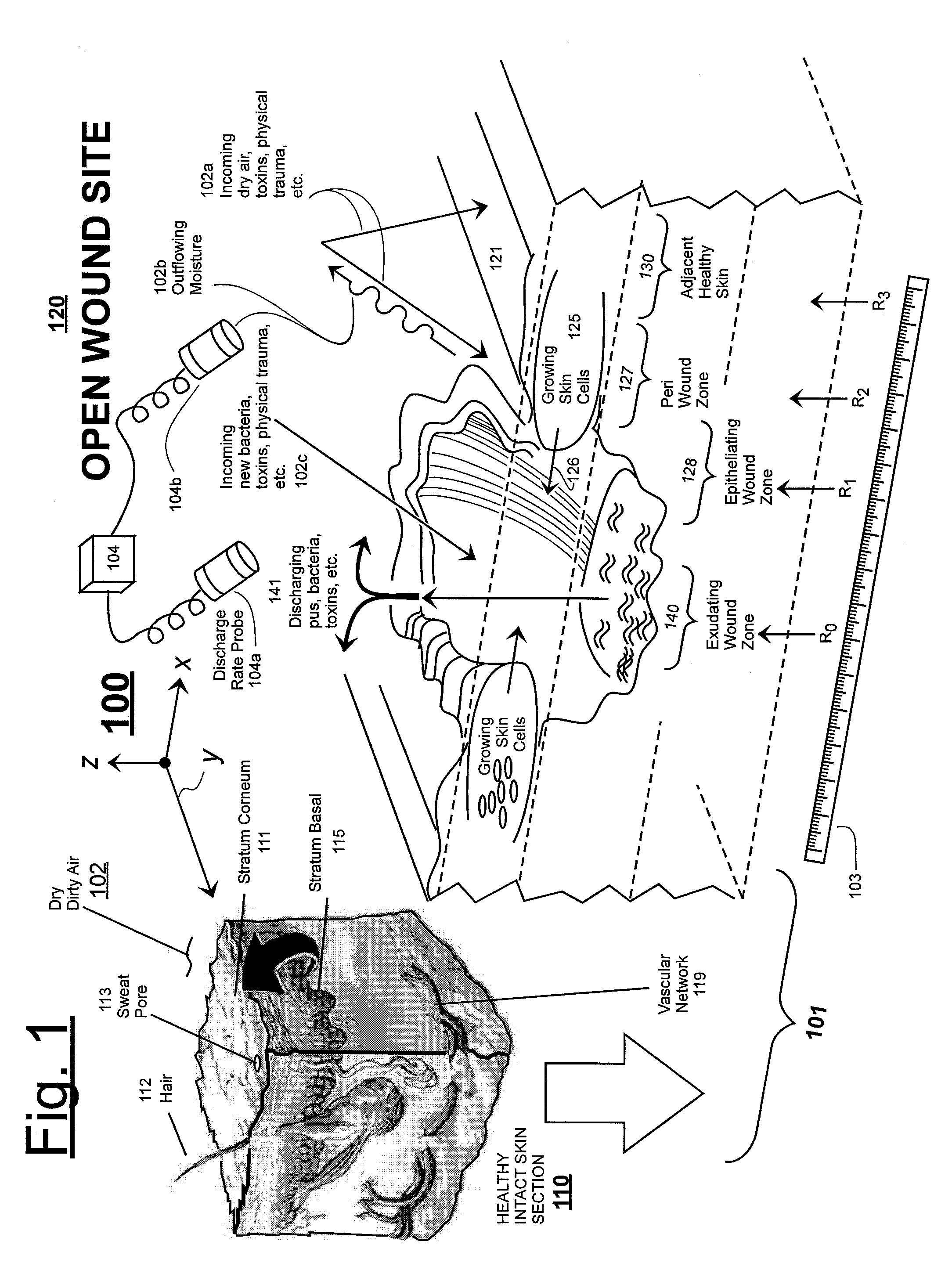 Expansion Units for Attachment to Custom Patterned Wound Dressings and Custom Patterned Wound Dressings Adapted to Interface With Same