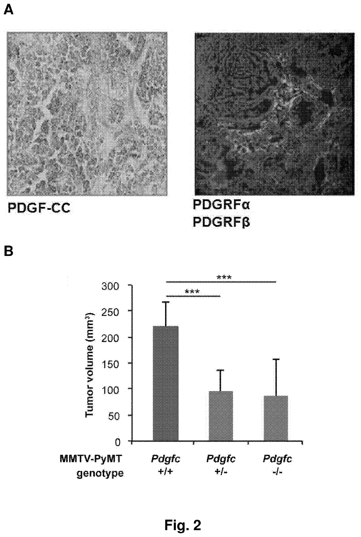 Treatment of er-negative breast cancer with an pdgf-cc inhibitor and Anti-estrogen
